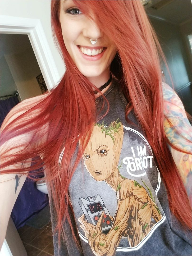 Smiling with confidence. No more braces!