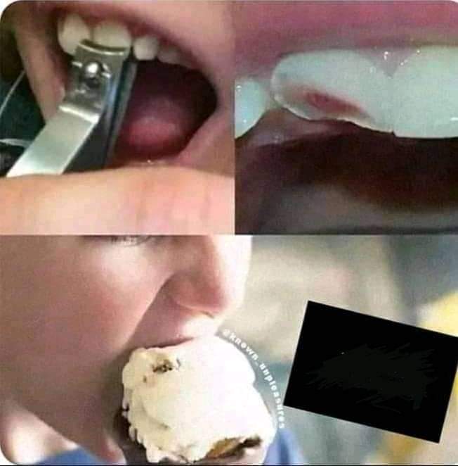 Thanks i hate teeths