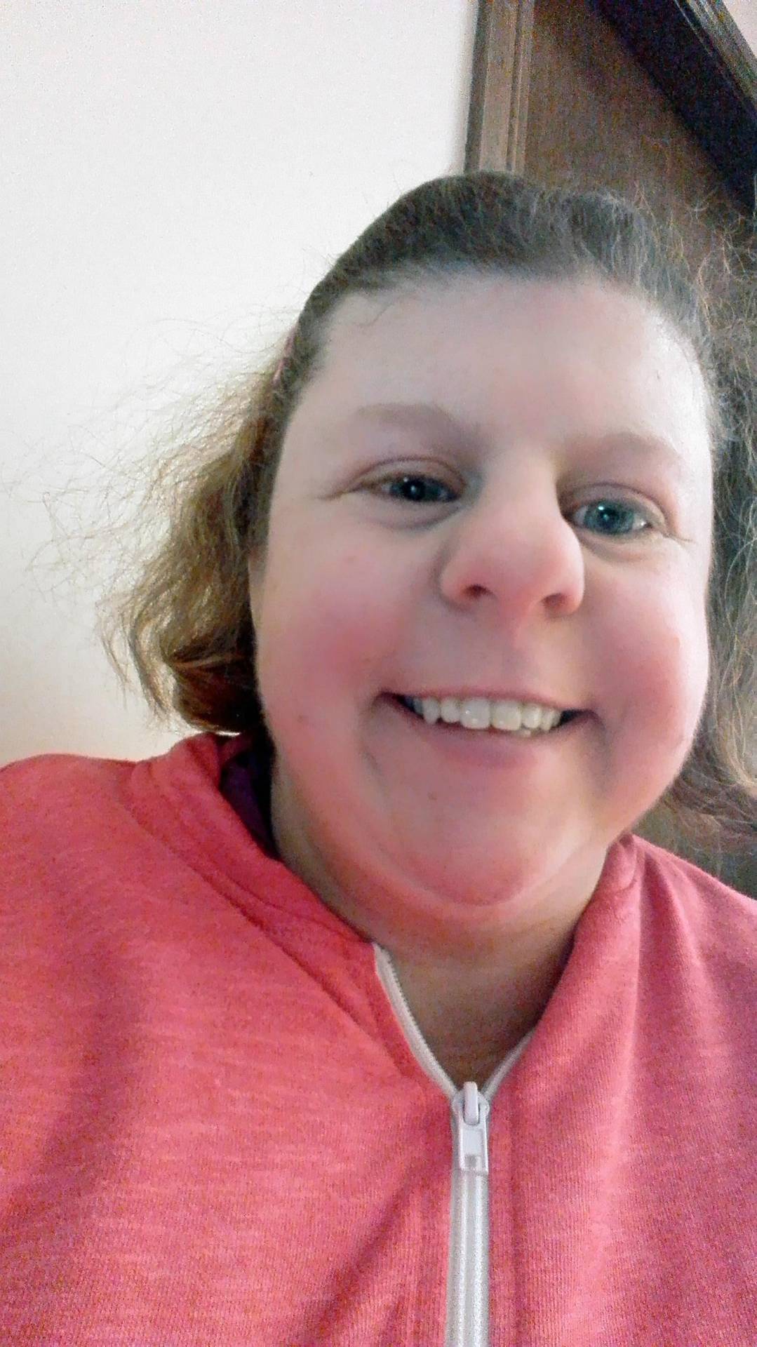 The face of Williams syndrome