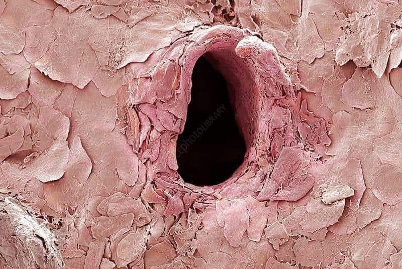 Your skin after a needle punctures it, as seen from a scanning electron microscope.