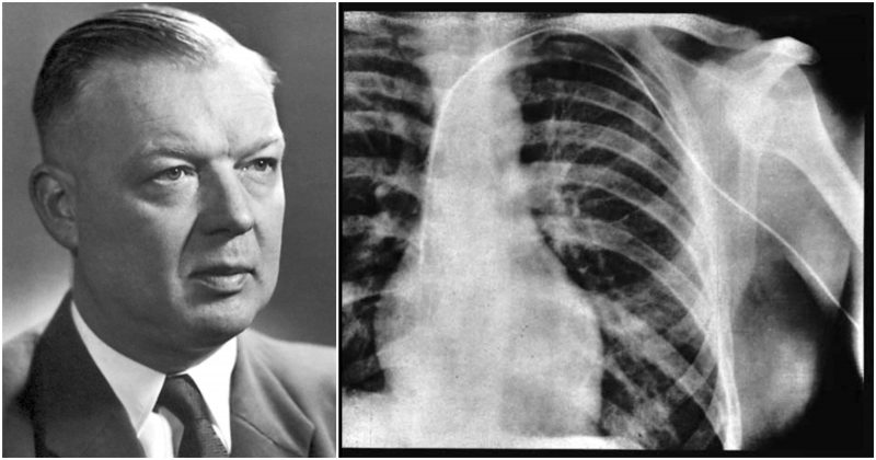 Discover more like Cardiology: TIL the first man to perform cardiac ...