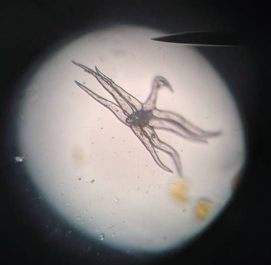 What the heck is this weird cell/group of cells from a cheek cell swab??