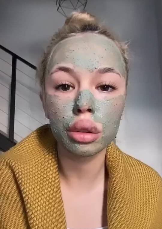 Why do her lips now look permanently bruised every time they're bare?