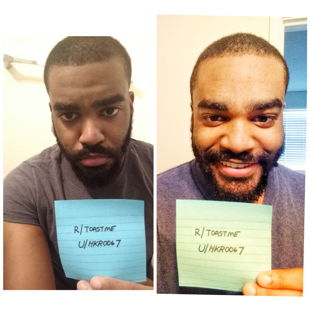 Yesterday vs Today. Thanks for all of your comments to yesterday's picture. Currently jamming to the most positive music I can so that depression doesn't have room today.