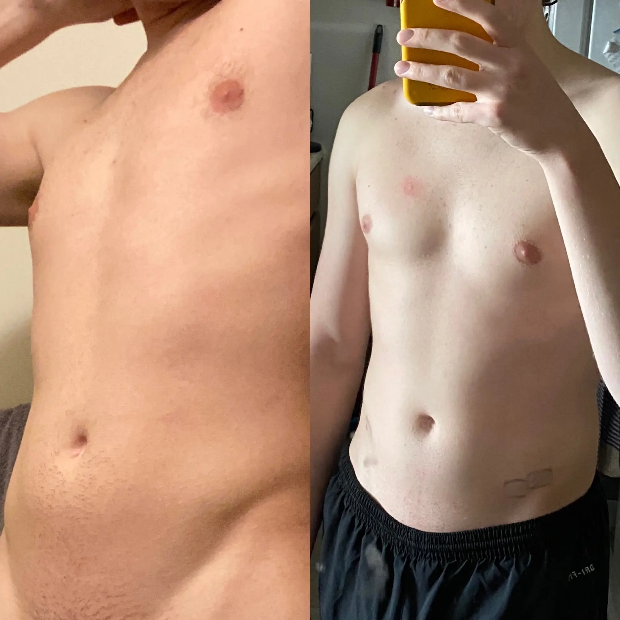 -1 month vs 6 weeks on spiro, 0.5 per day patch E | Scrolller