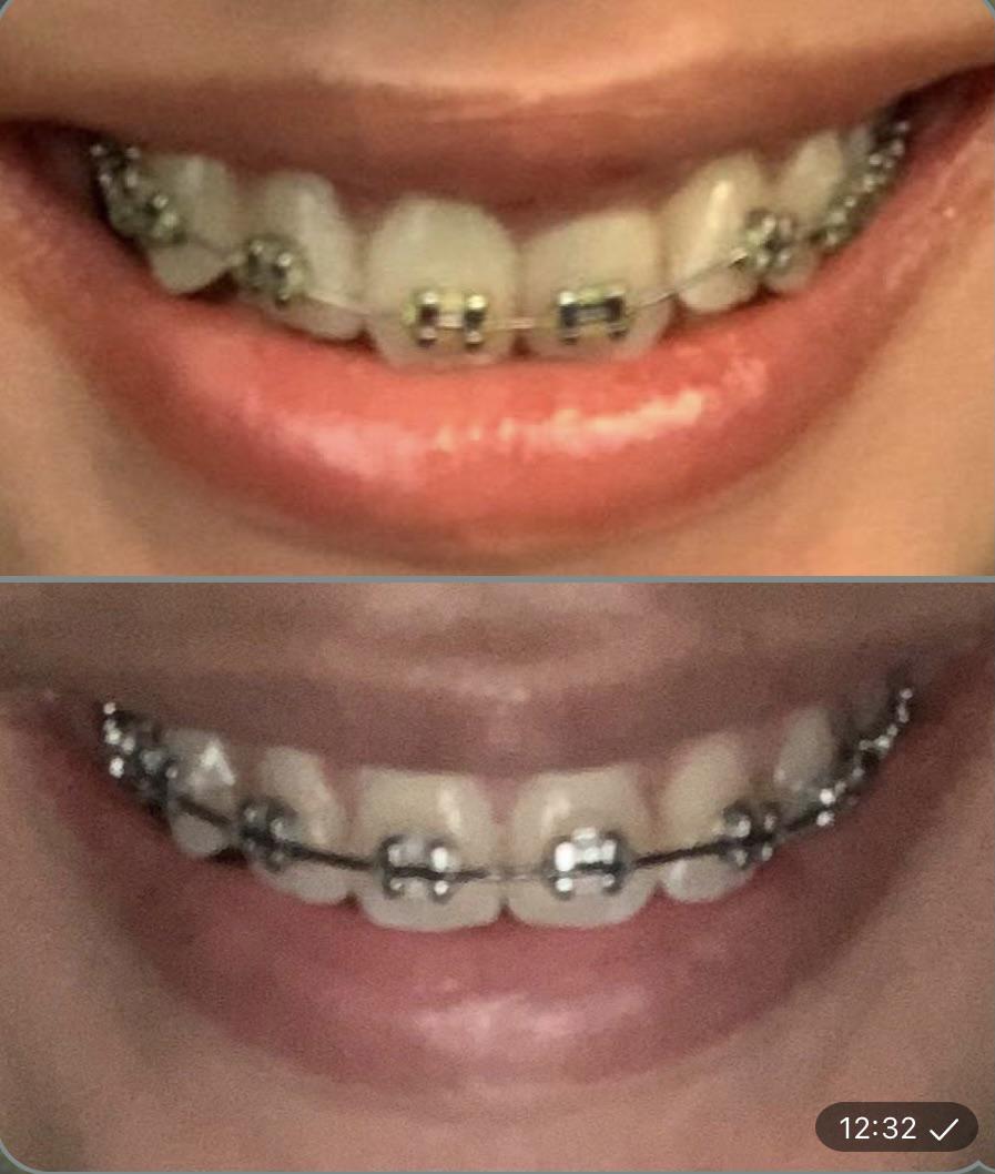 2-and-a-half-months-progress-scrolller