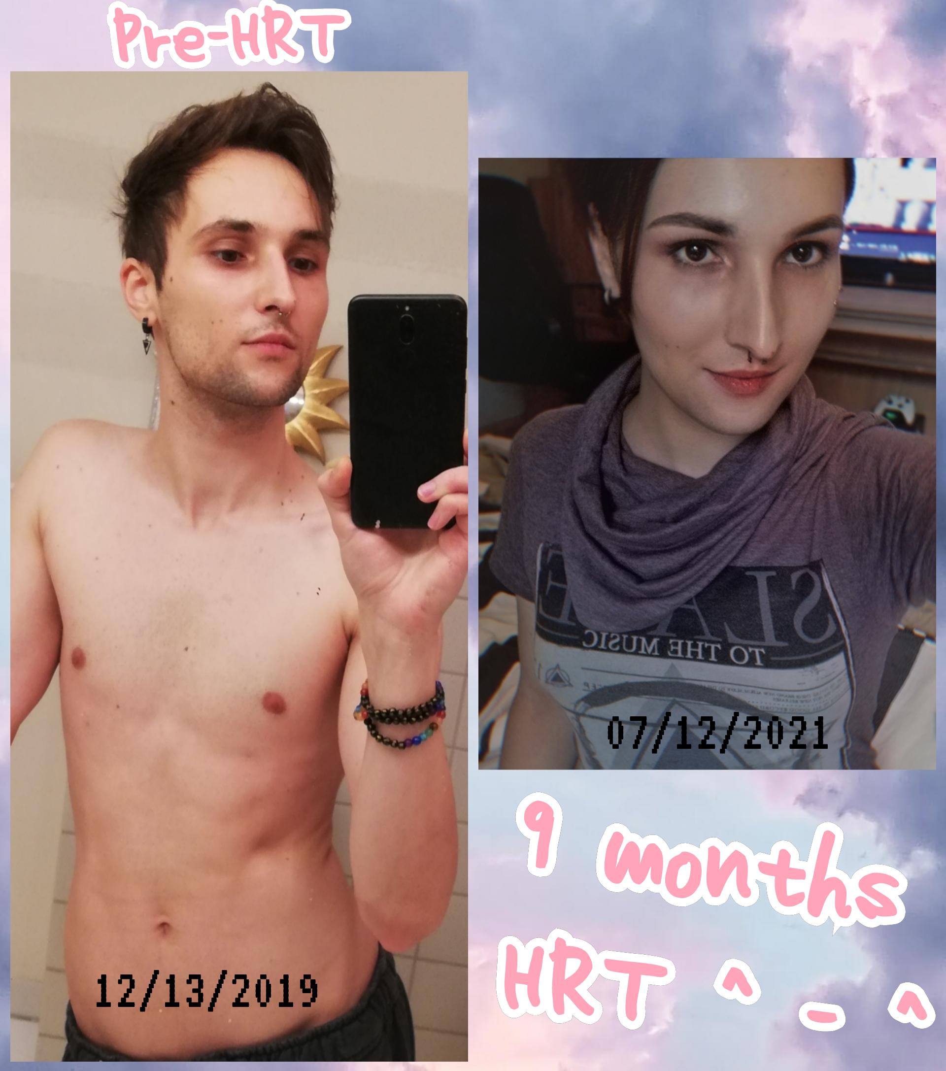 9 Months Transition At Age 30 Scrolller