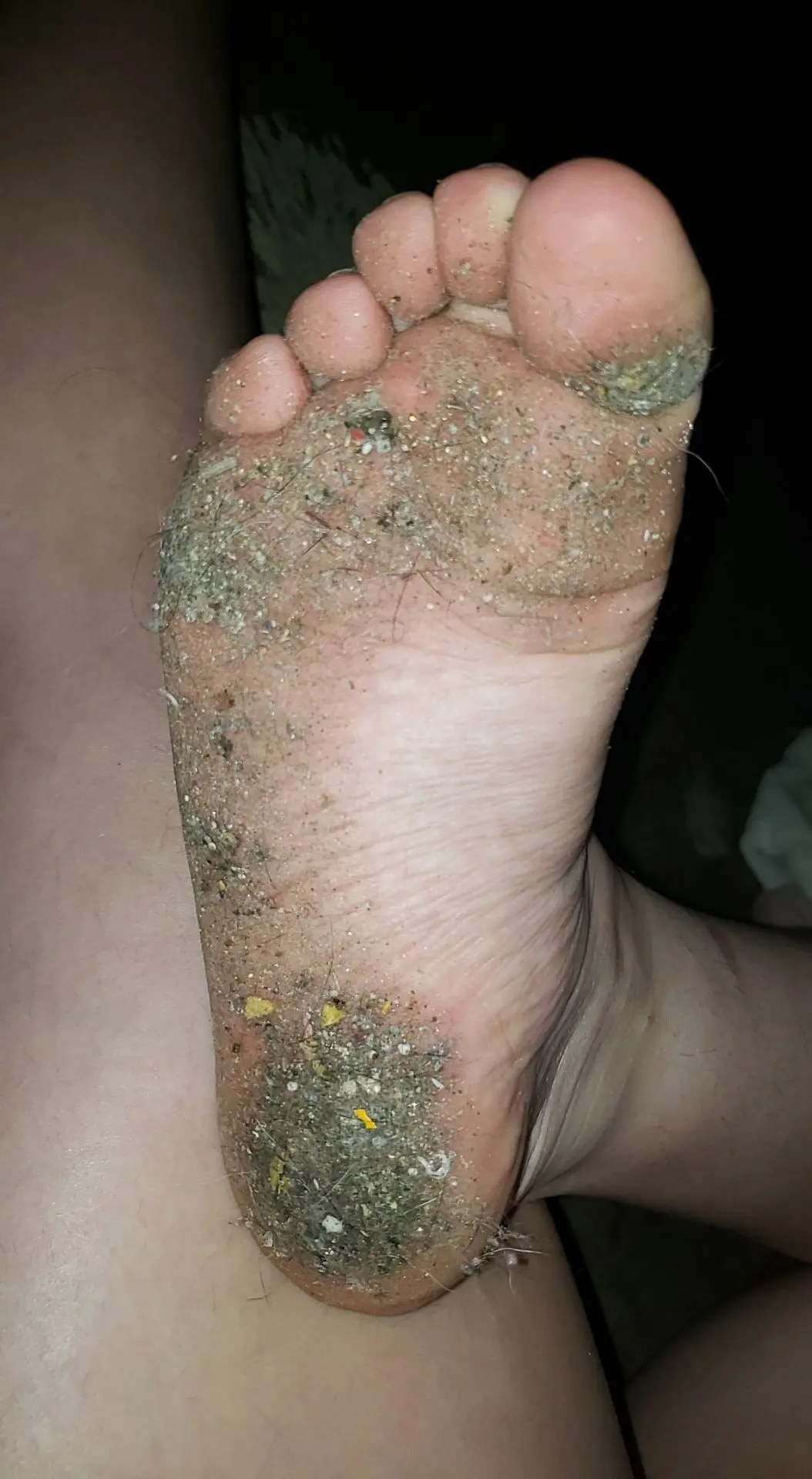 Toes Discusting DISCUSTING TOES!!! who would still clean them??!! | Scrolller