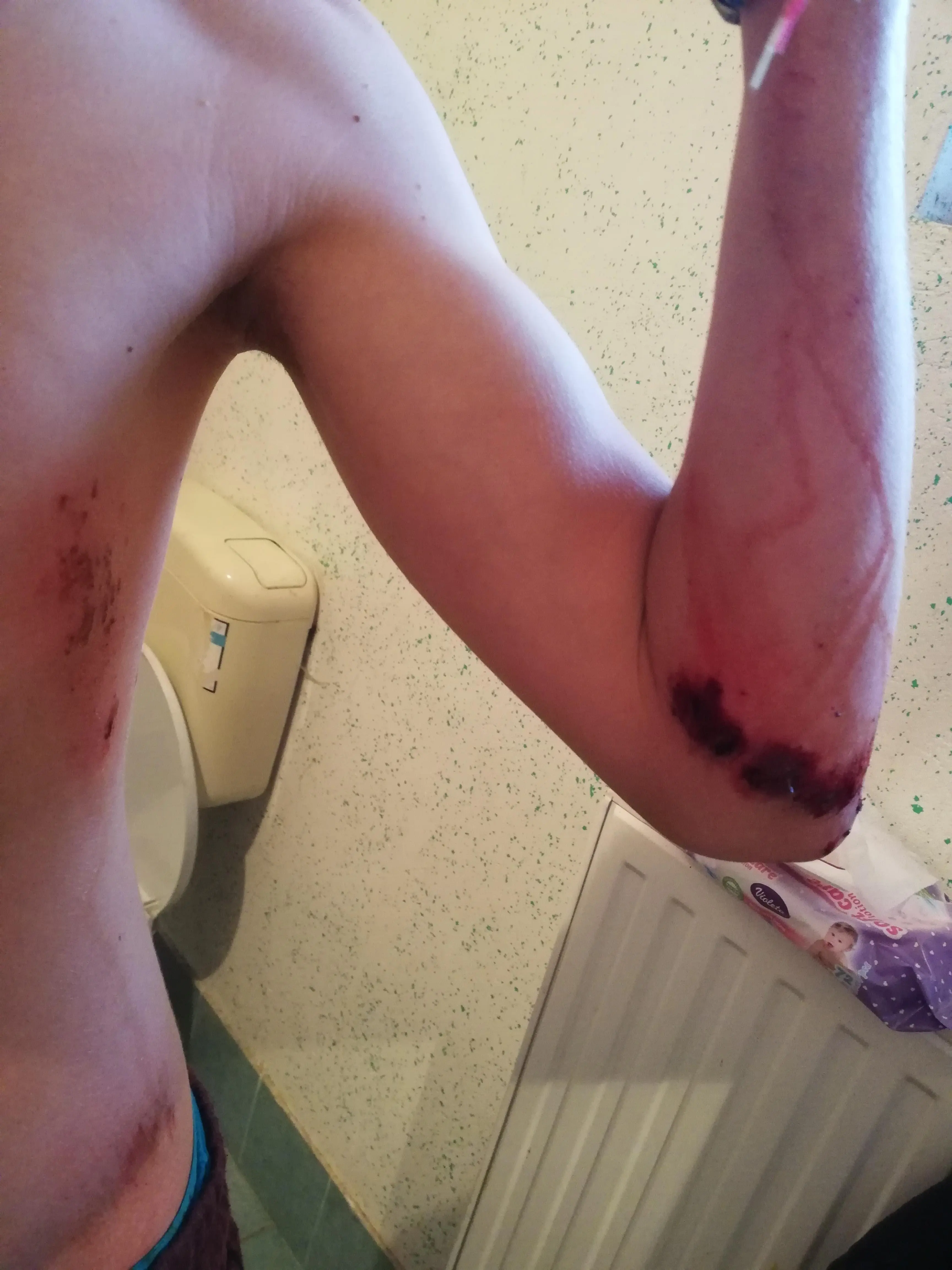 Fell off my motorbike with 45km/h. But guess what! I'm still in the Club boys