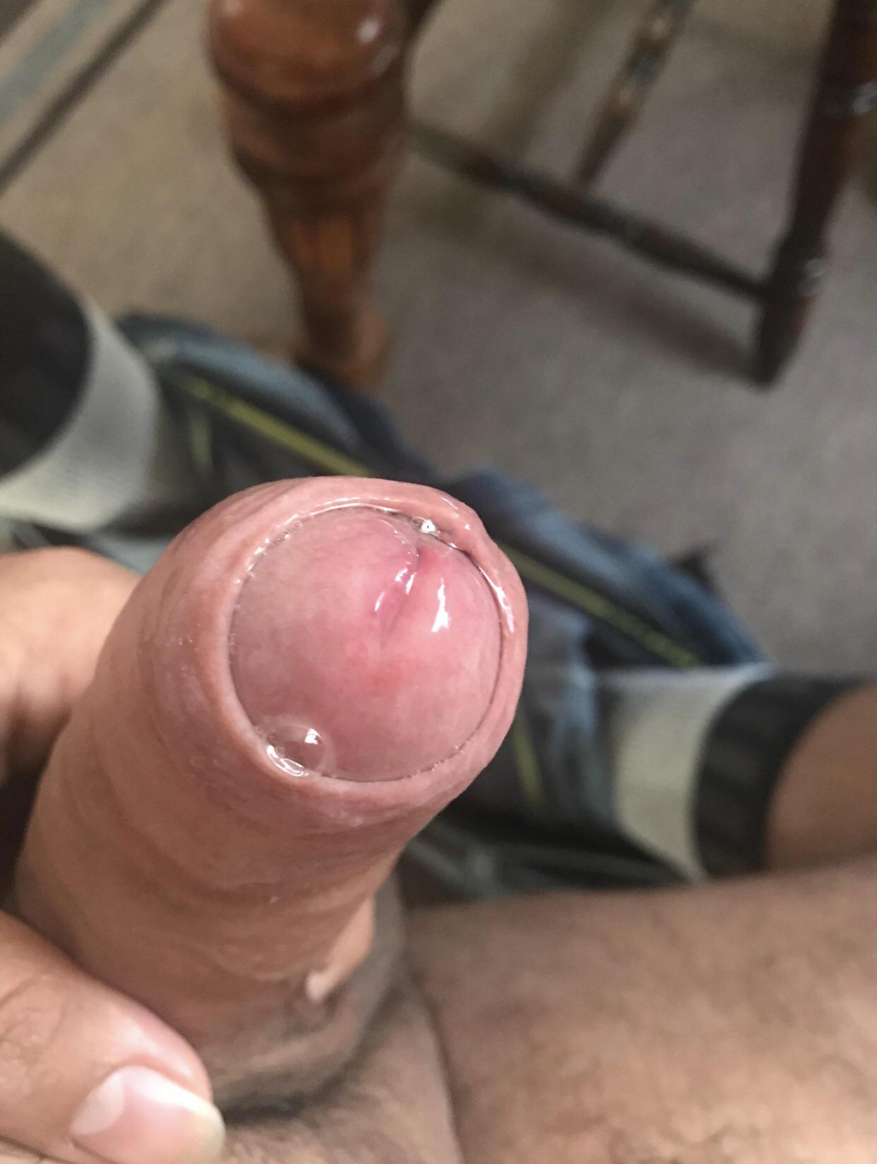 Slideshow foreskin precum.