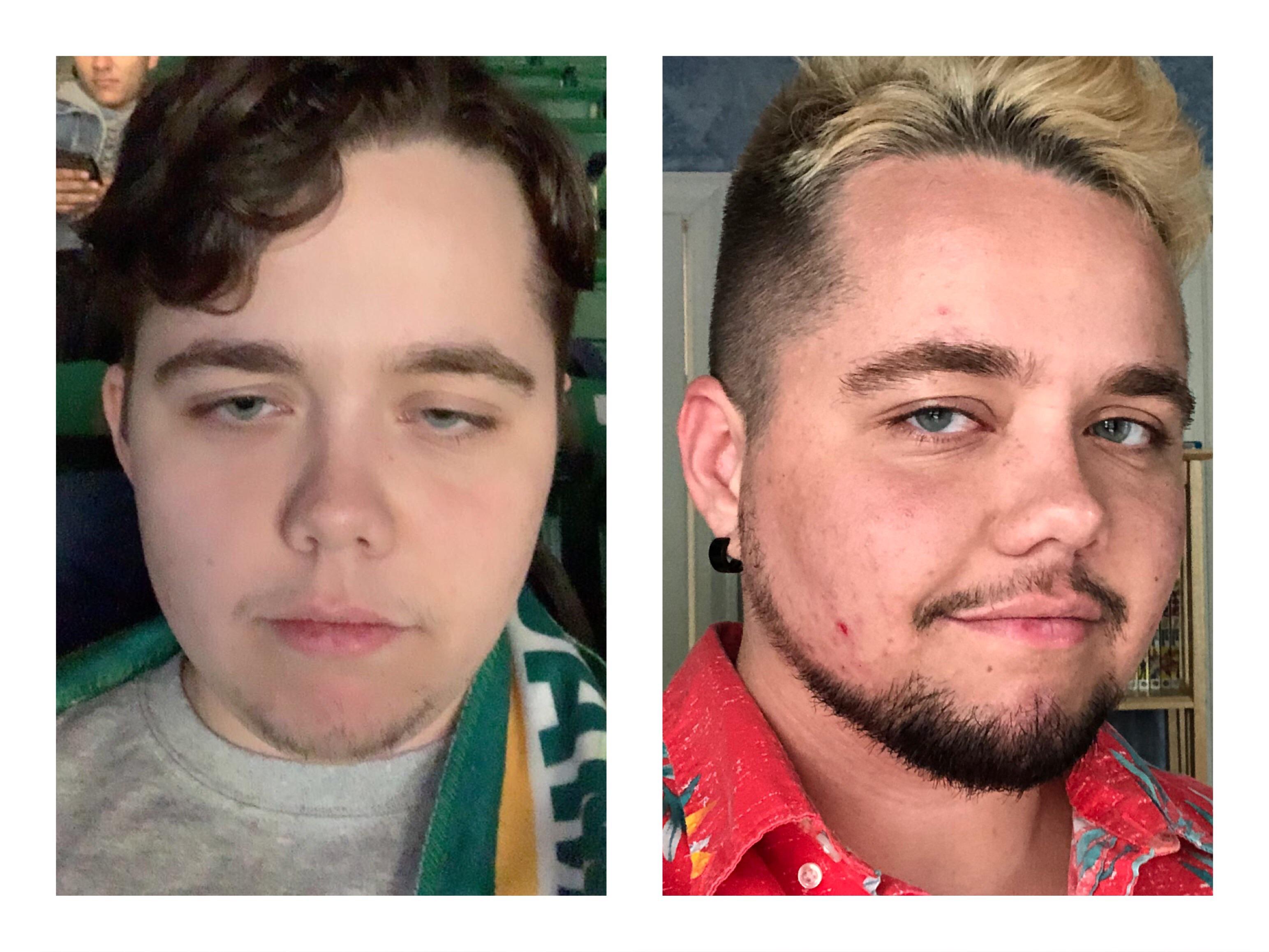 Single Ftm ftm bro here, heres my results after 6 months of on and off use. def a ...