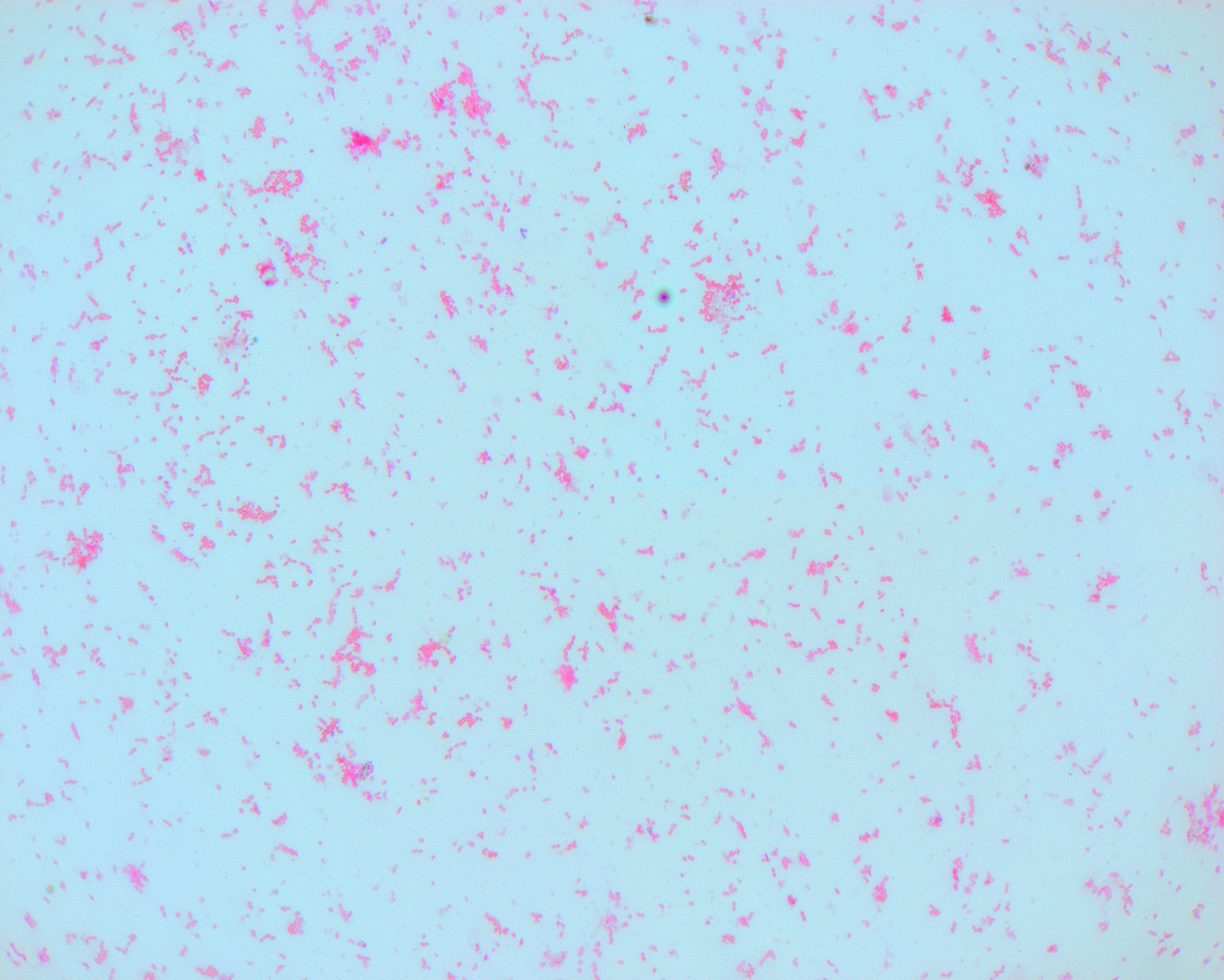 [Gram stain] Neisseria meningitidis from a male urethral sample | Scrolller