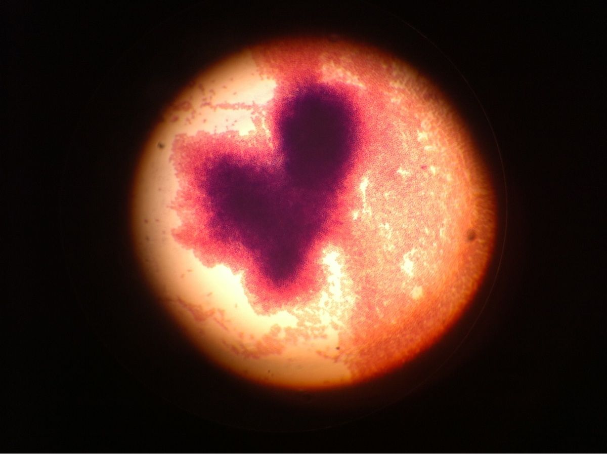 gram-staining-its-principle-procedure-and-results