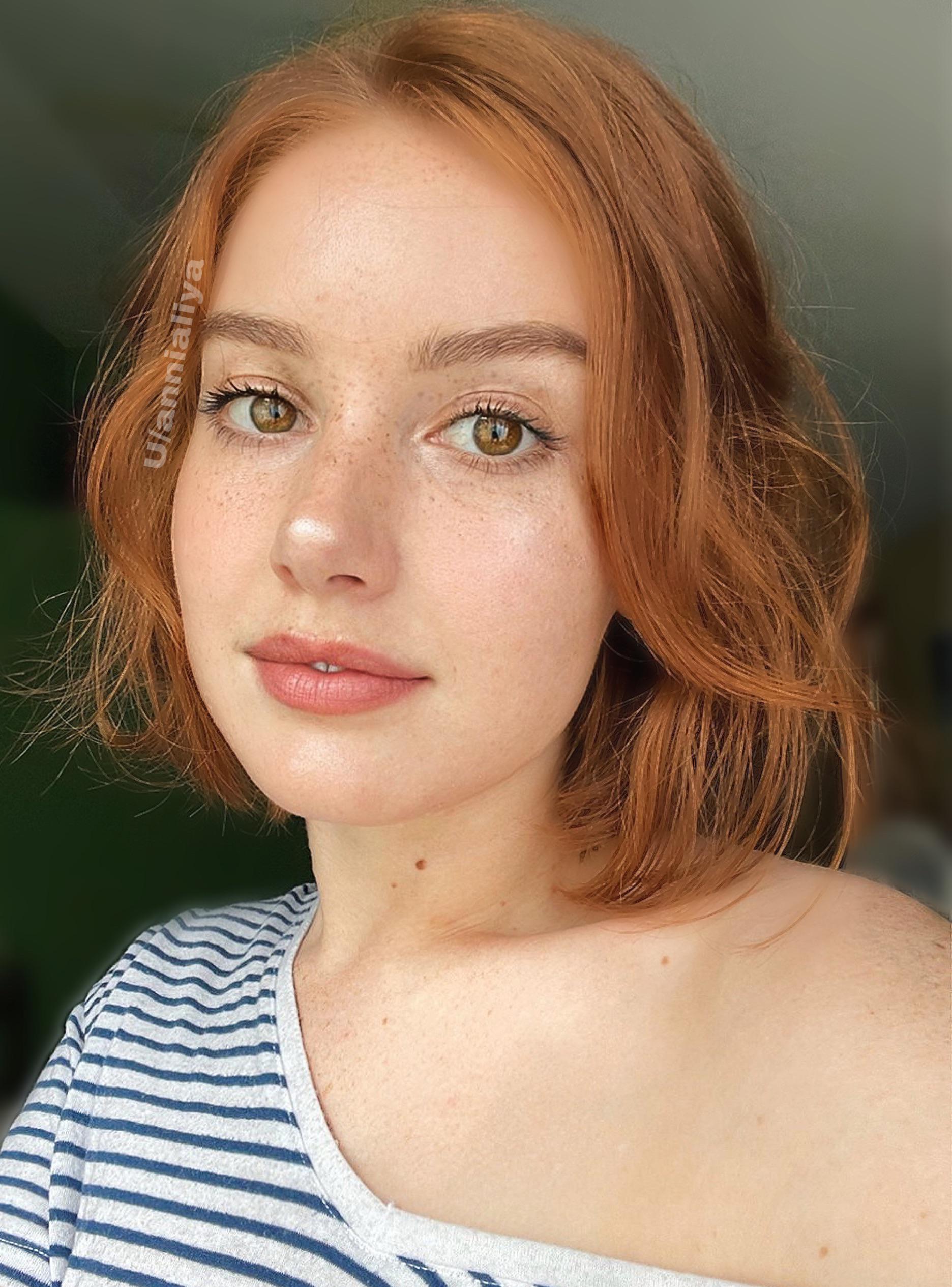 i-feel-like-all-gingers-struggled-with-hating-their-freckles-growing-up