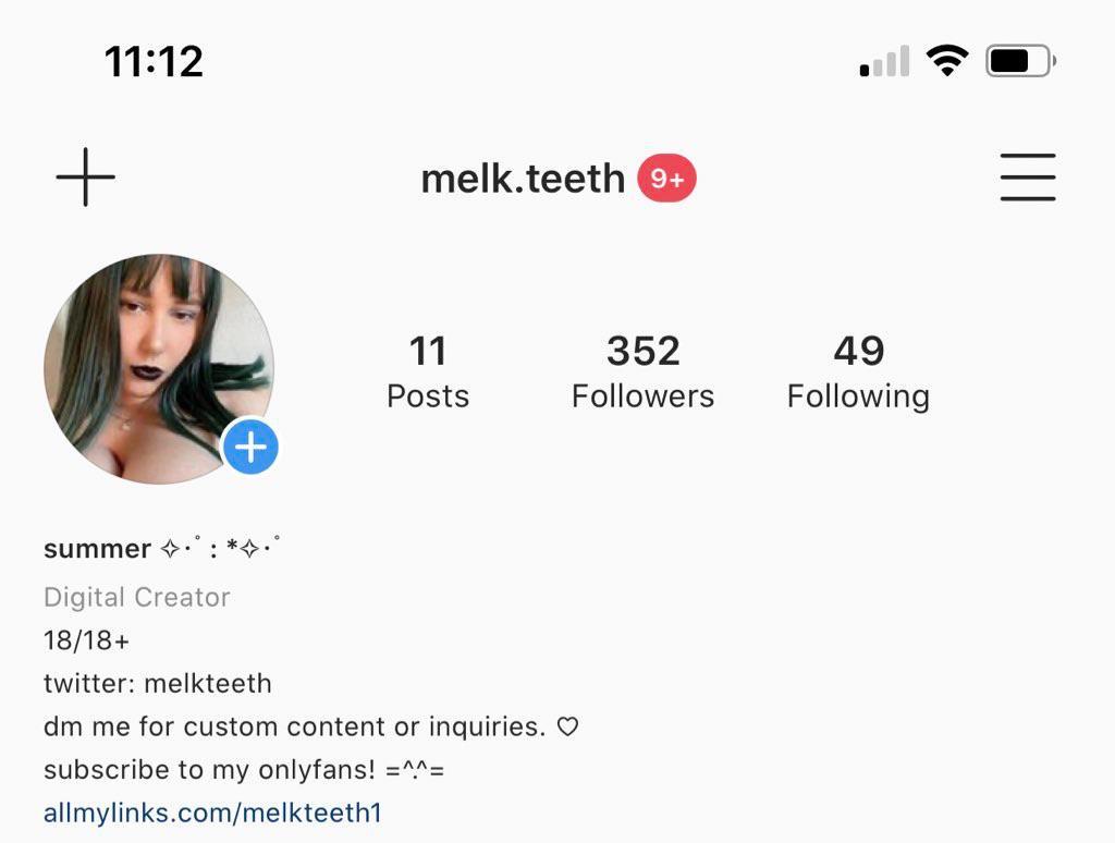 instagram.com/melk.teeth follow it! please hehe | Scrolller