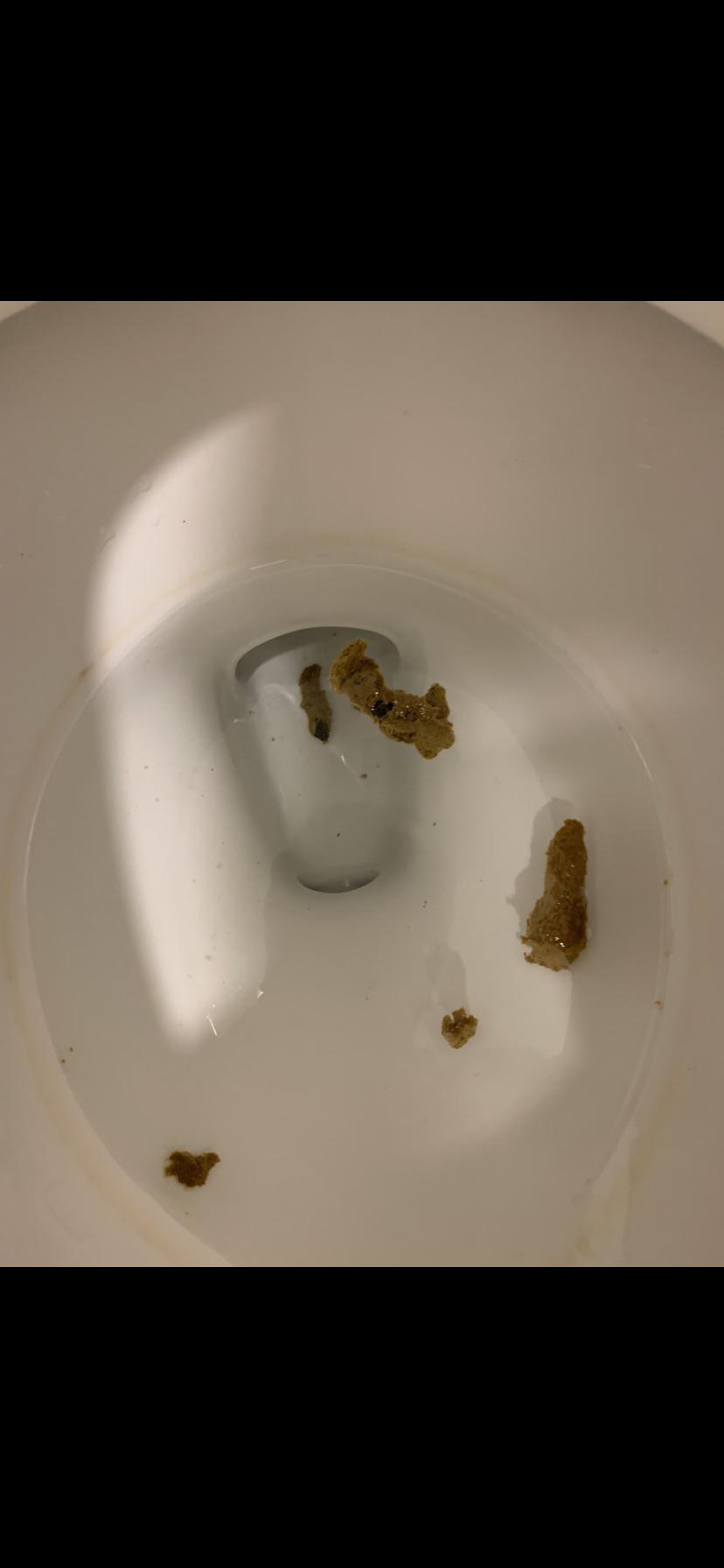Is this blood in my stool? | Scrolller