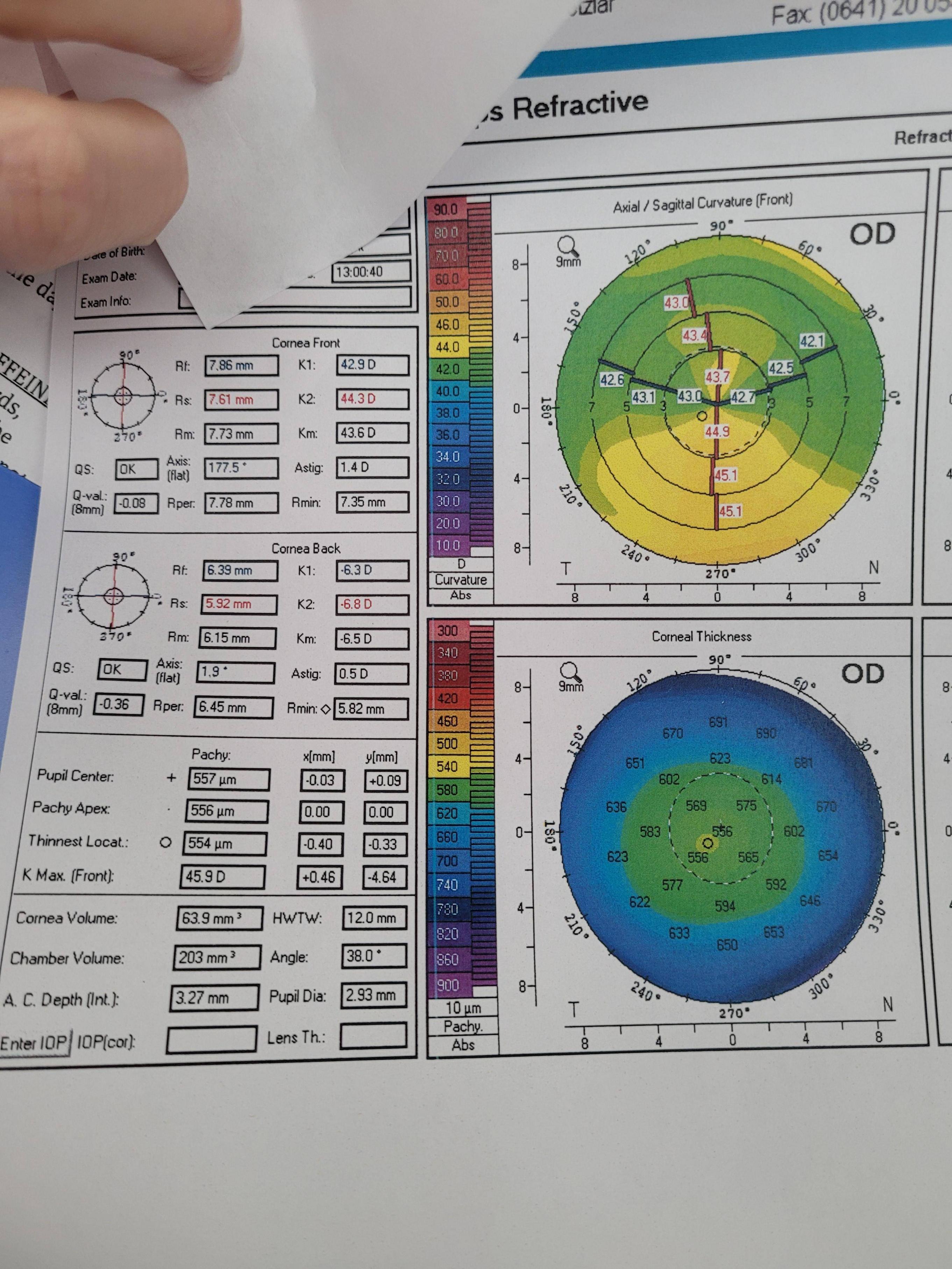 lasik-consultation-scrolller