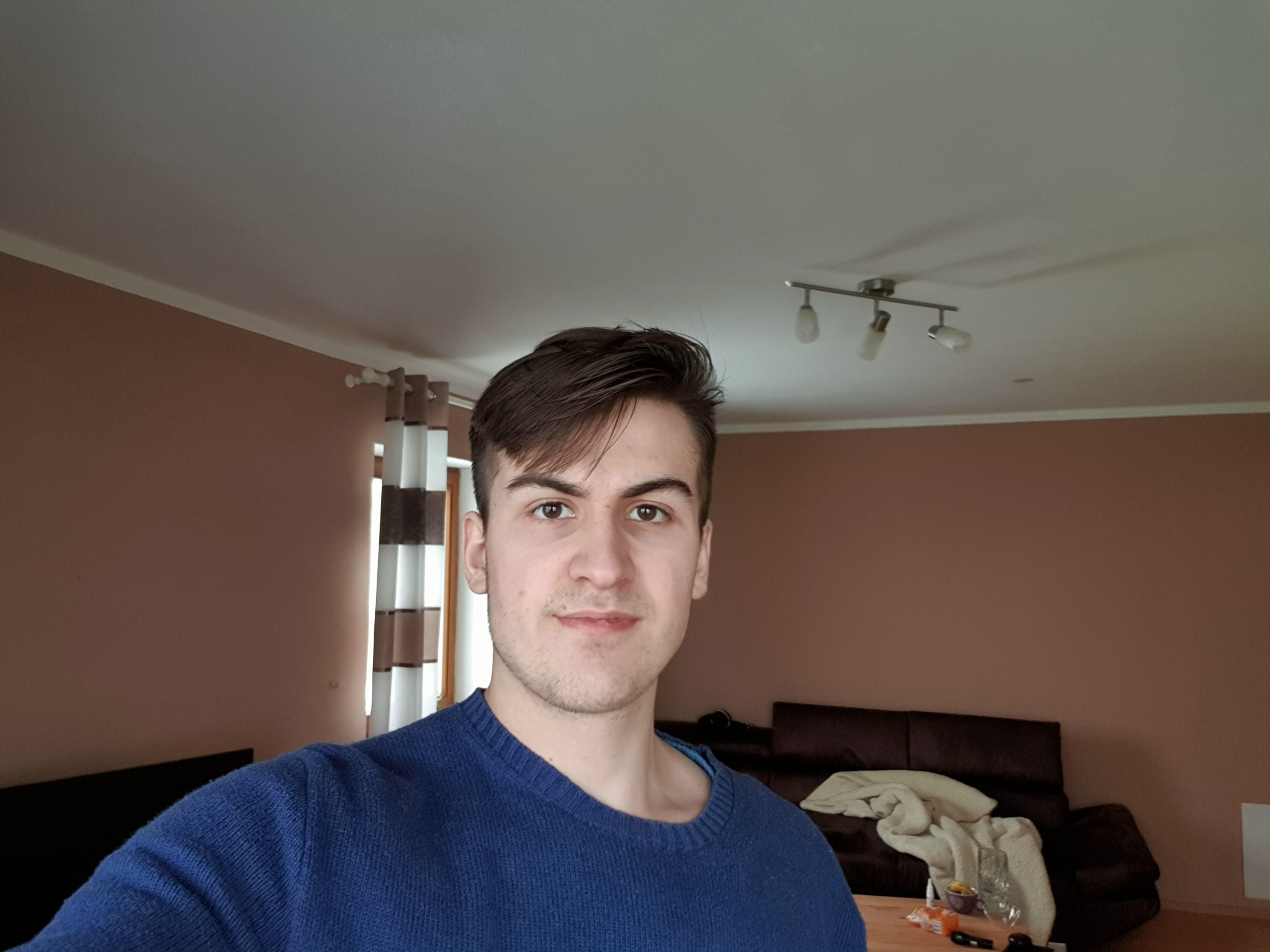 Bitemporal Width And Facial Harmony: The Unexpected Connection - 4r5imzr