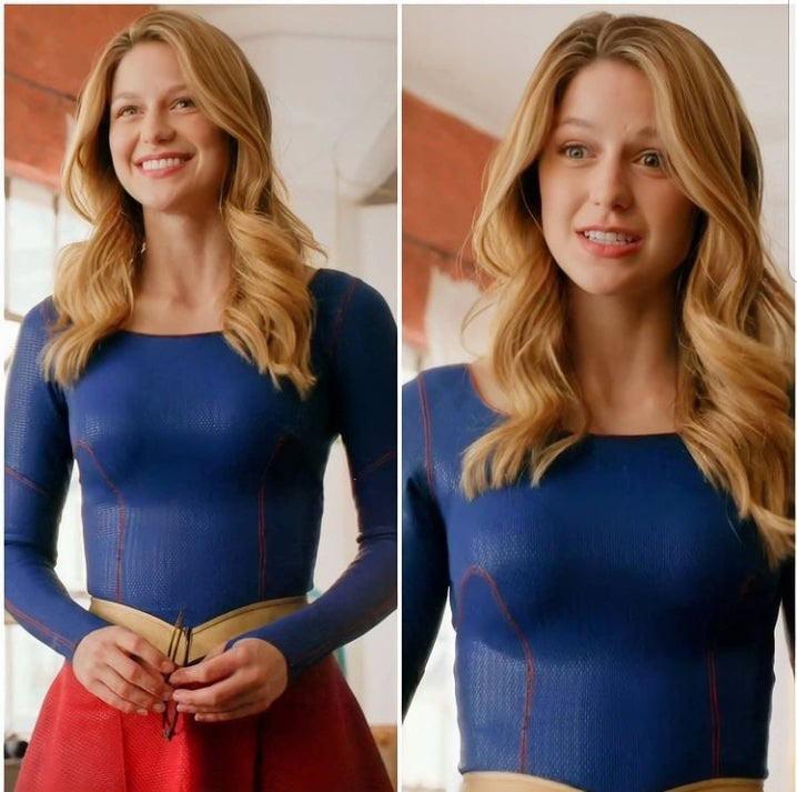 Melissa Benoist | Scrolller