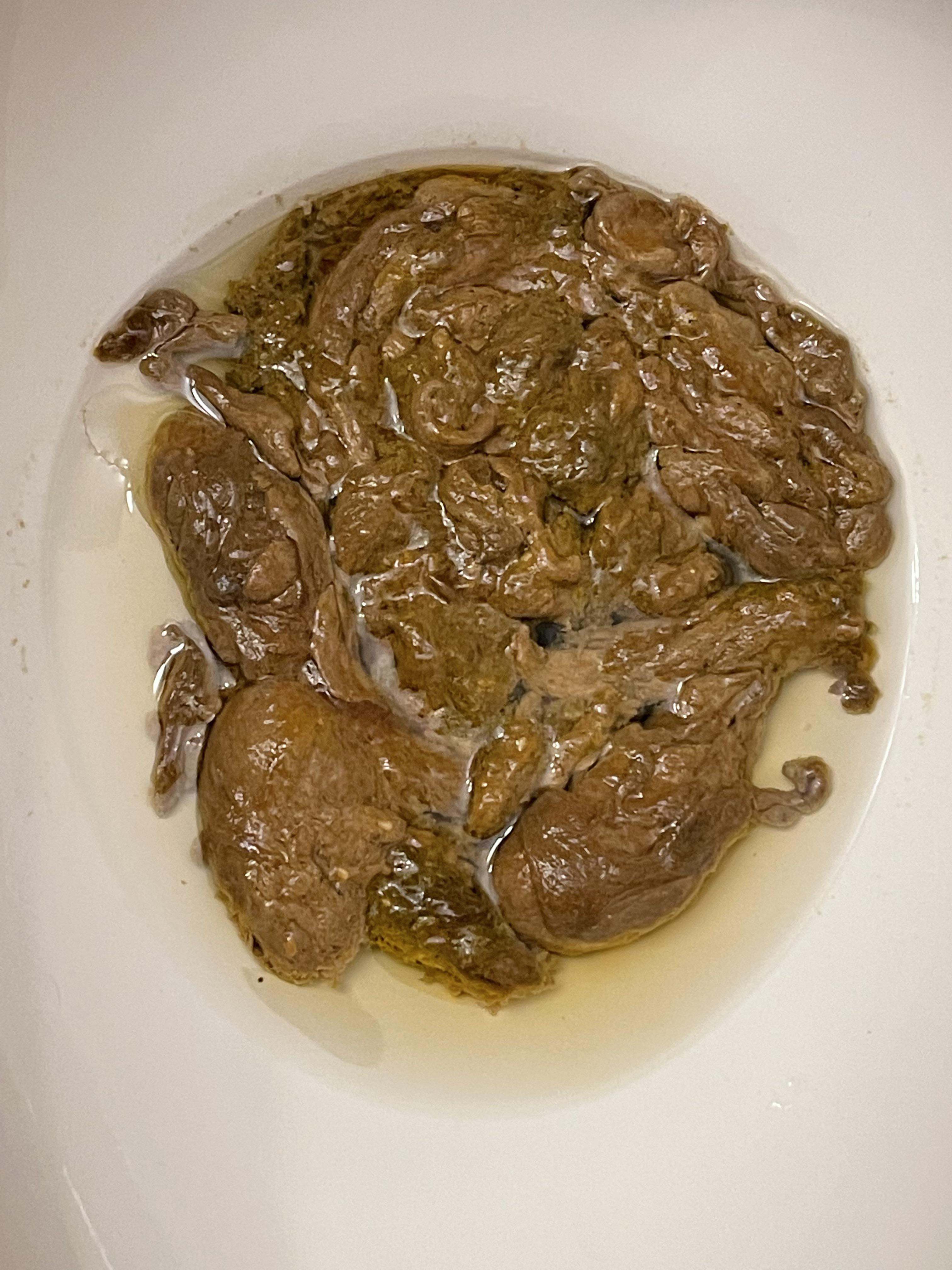 Miralax Vs Metamucil 34 - e6mk4e7
