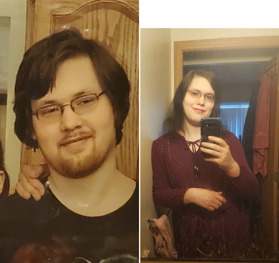 MtF 26 ?HRT prehatching to 5M HRT Scrolller