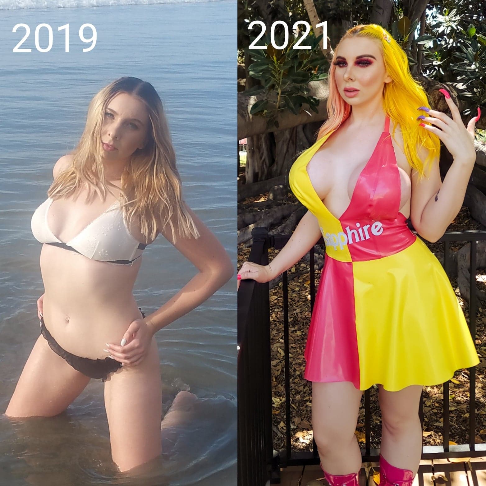 Sophie Rain'S Bbl: A Plastic Surgery Success Story? - pclc11t