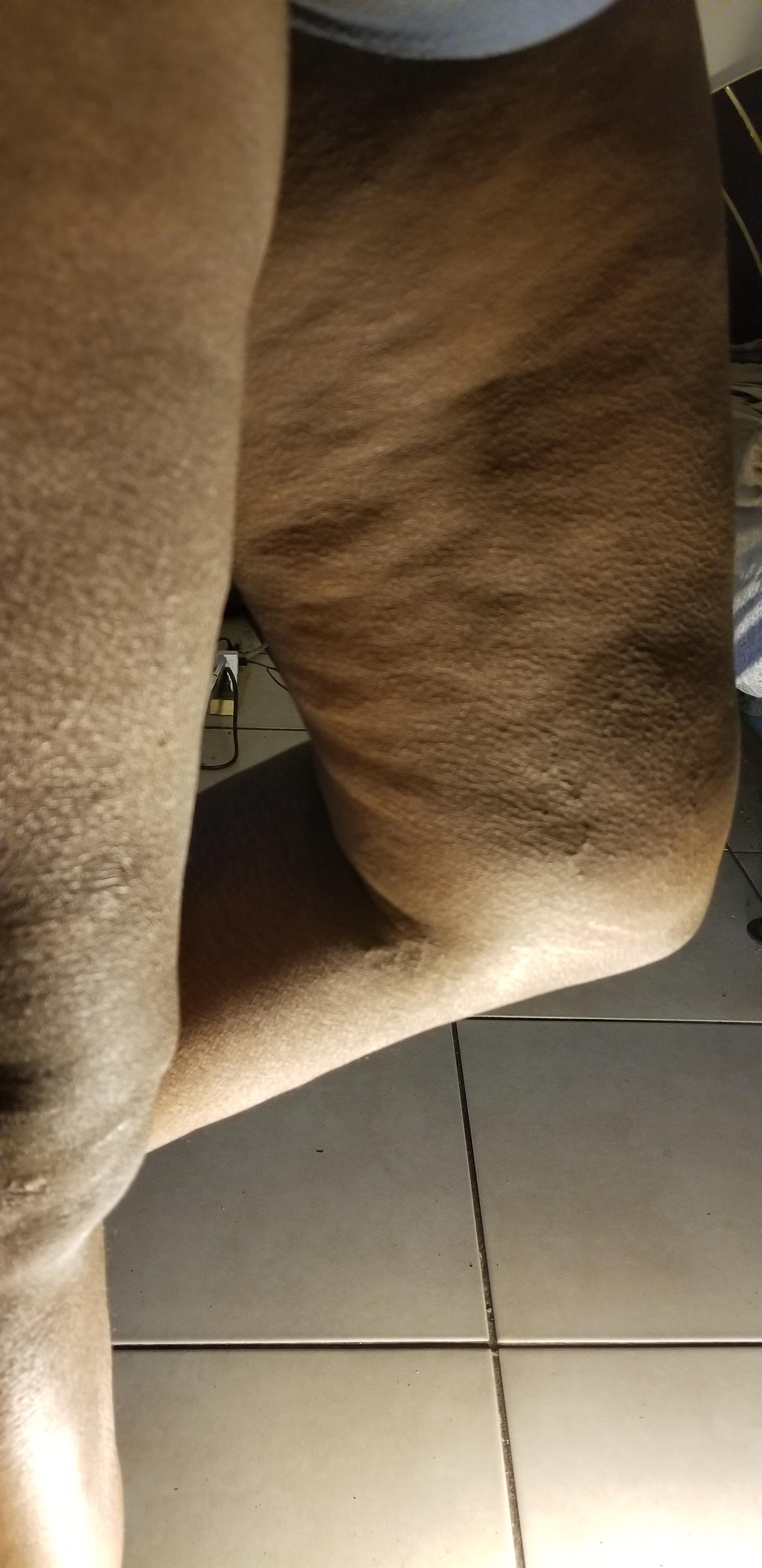 Sarah's Cottage Cheese Thighs Scrolller