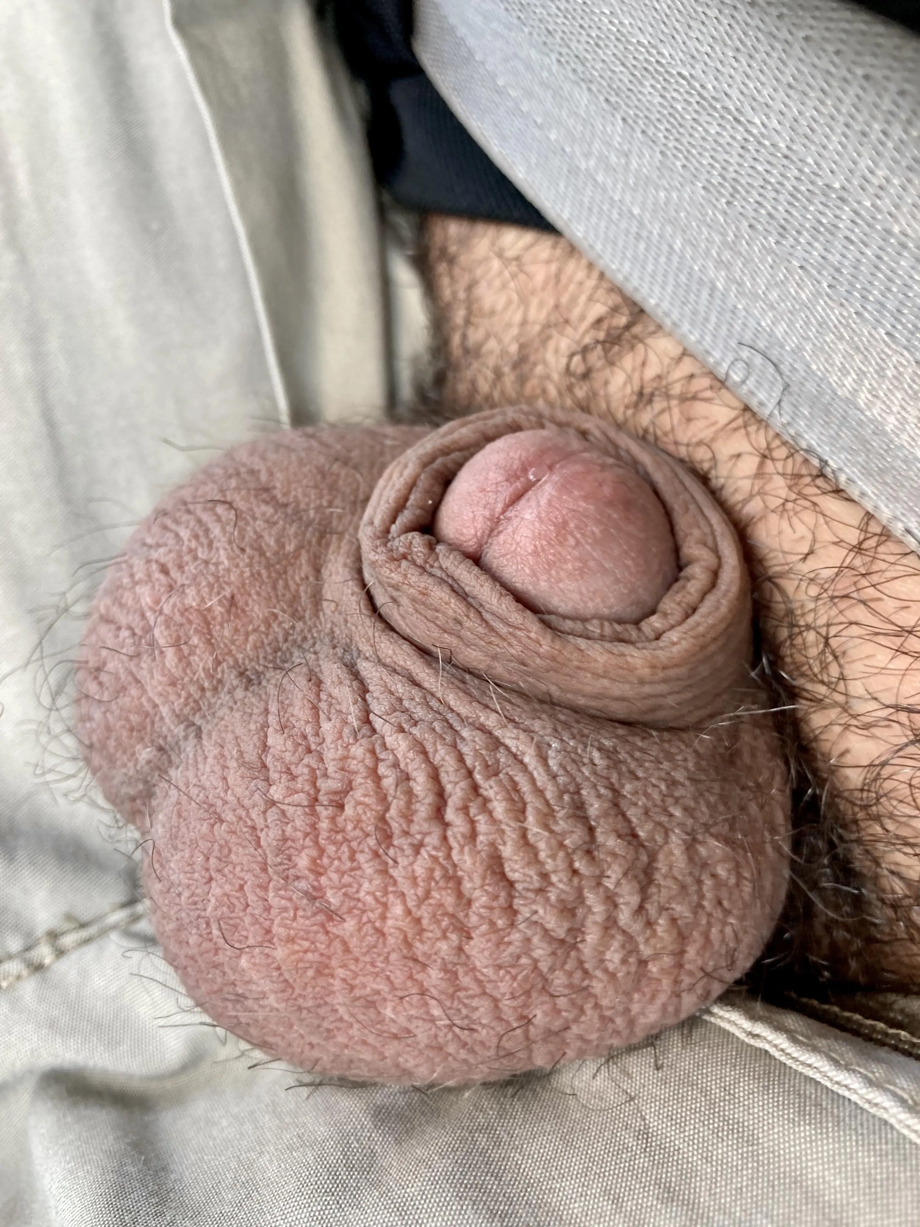 The incredible shrinking penis