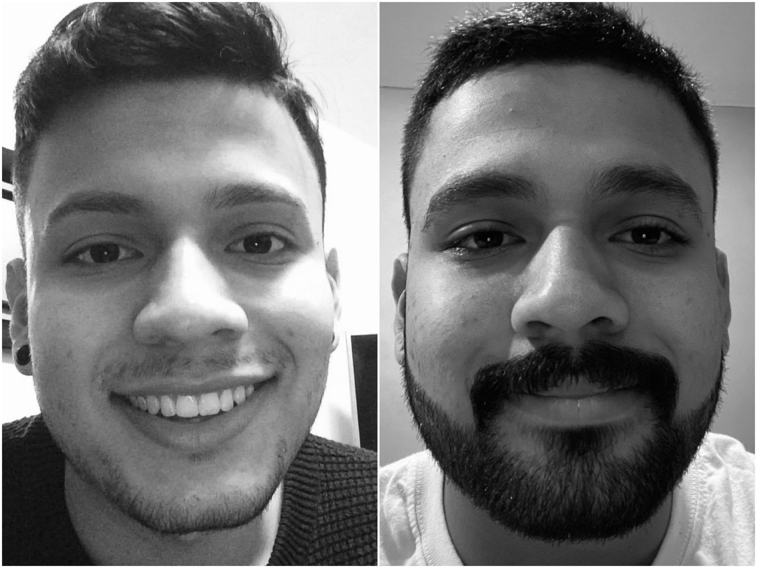 Stachebeard. About 3 year difference. Scrolller