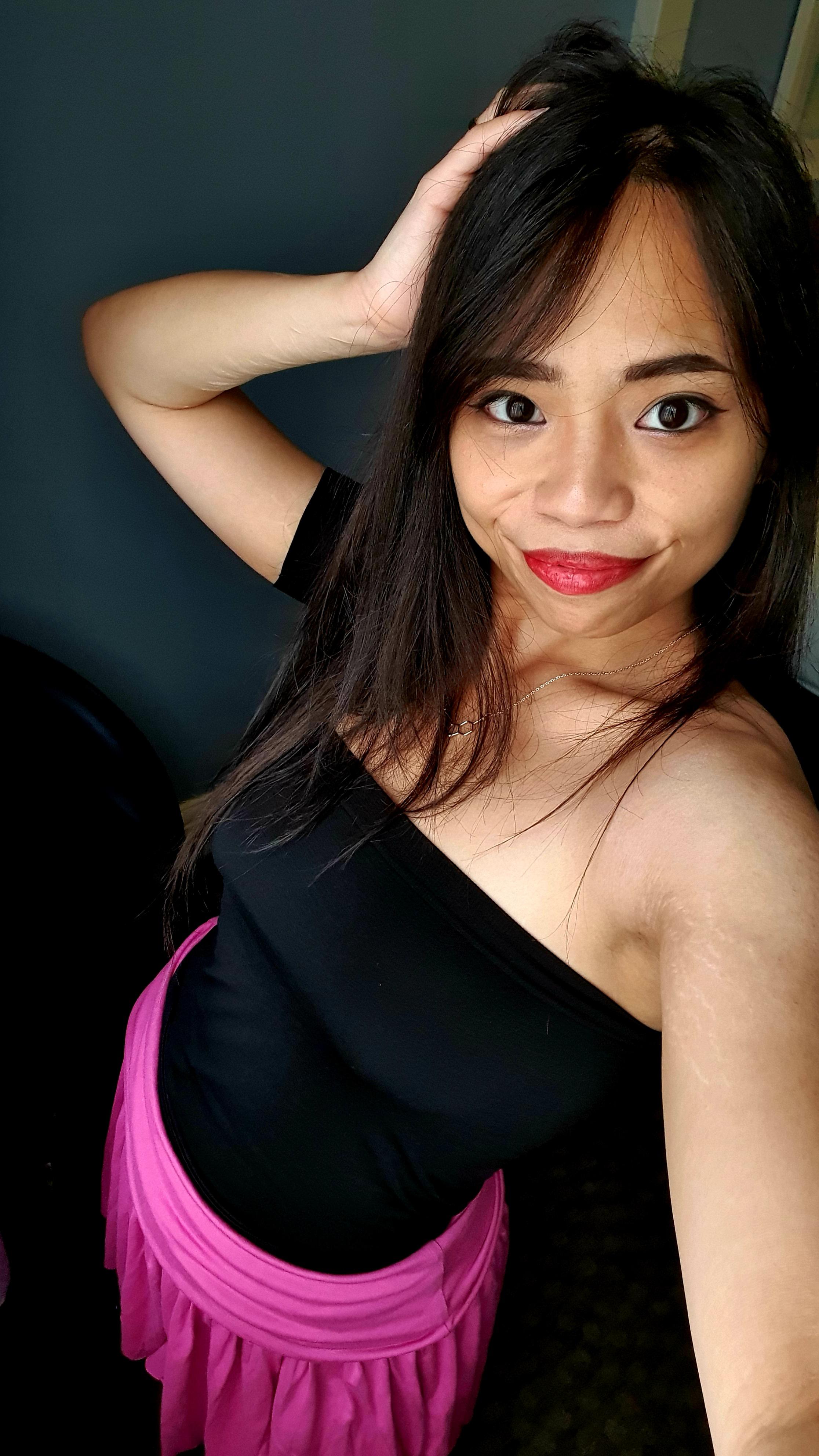 Stopped Wearing Long Sleeves To Hide My SH Scars In The Last Year stopped-wearing-long-sleeves-to-hide-my-sh-scars-in-the-last-year