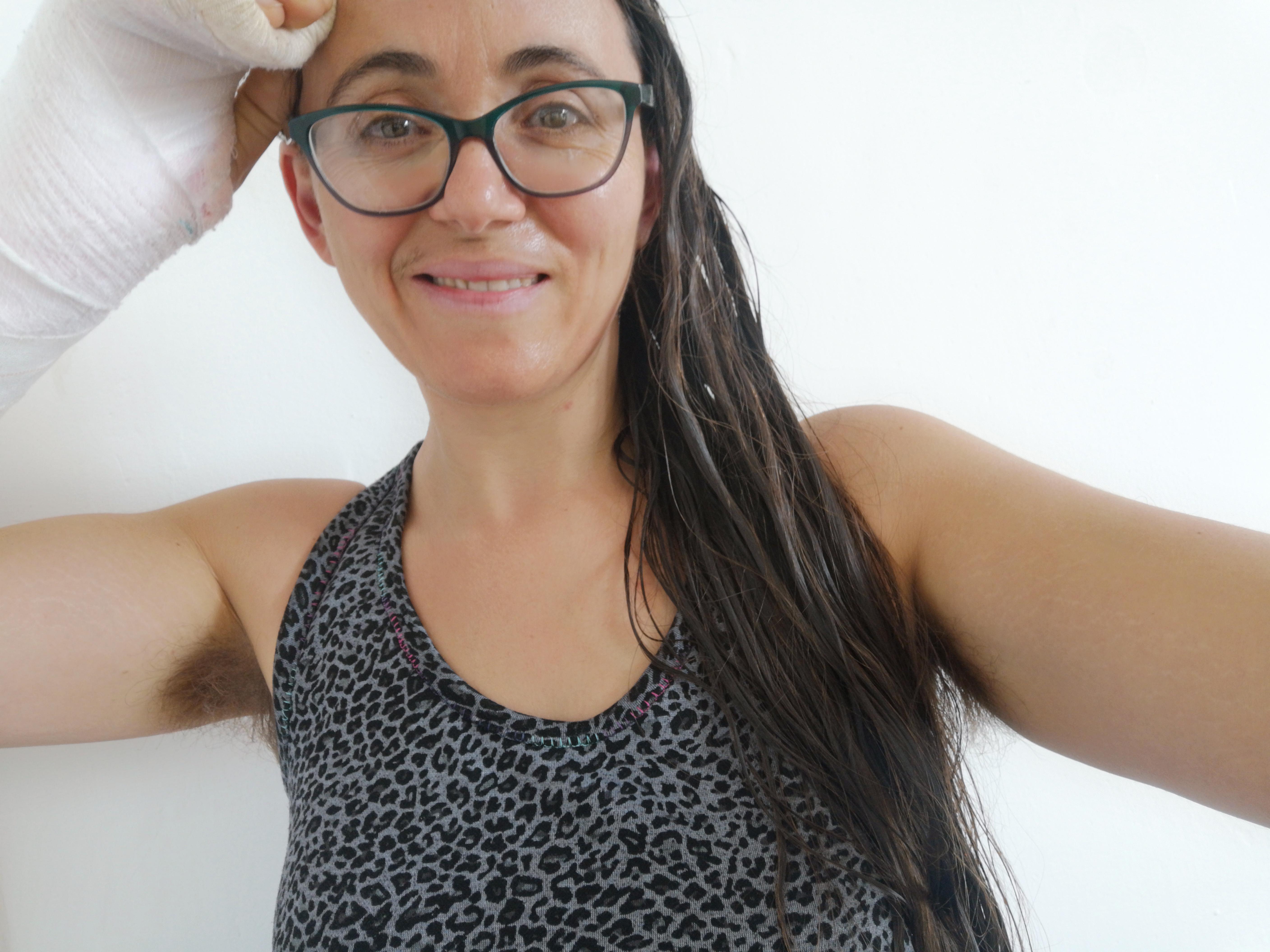 Thank god having a broken hand doesn't hide my pits 😂 Scrolller