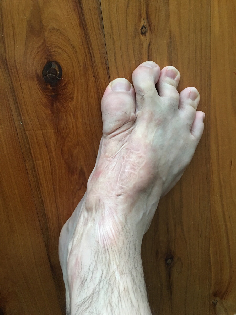 We're on gross feet? Here's my entry. Scrolller