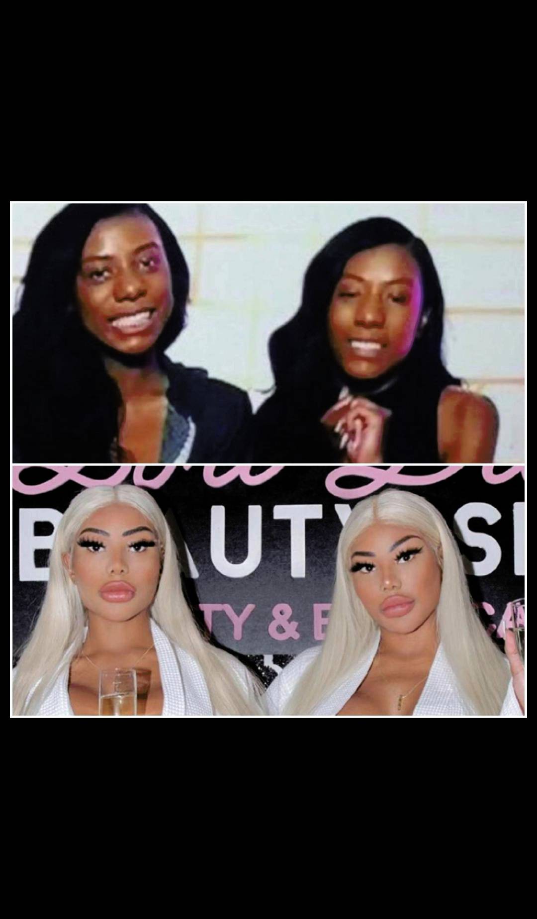 Clermont Twins BEFORE +AFTER 🤯 Scrolller