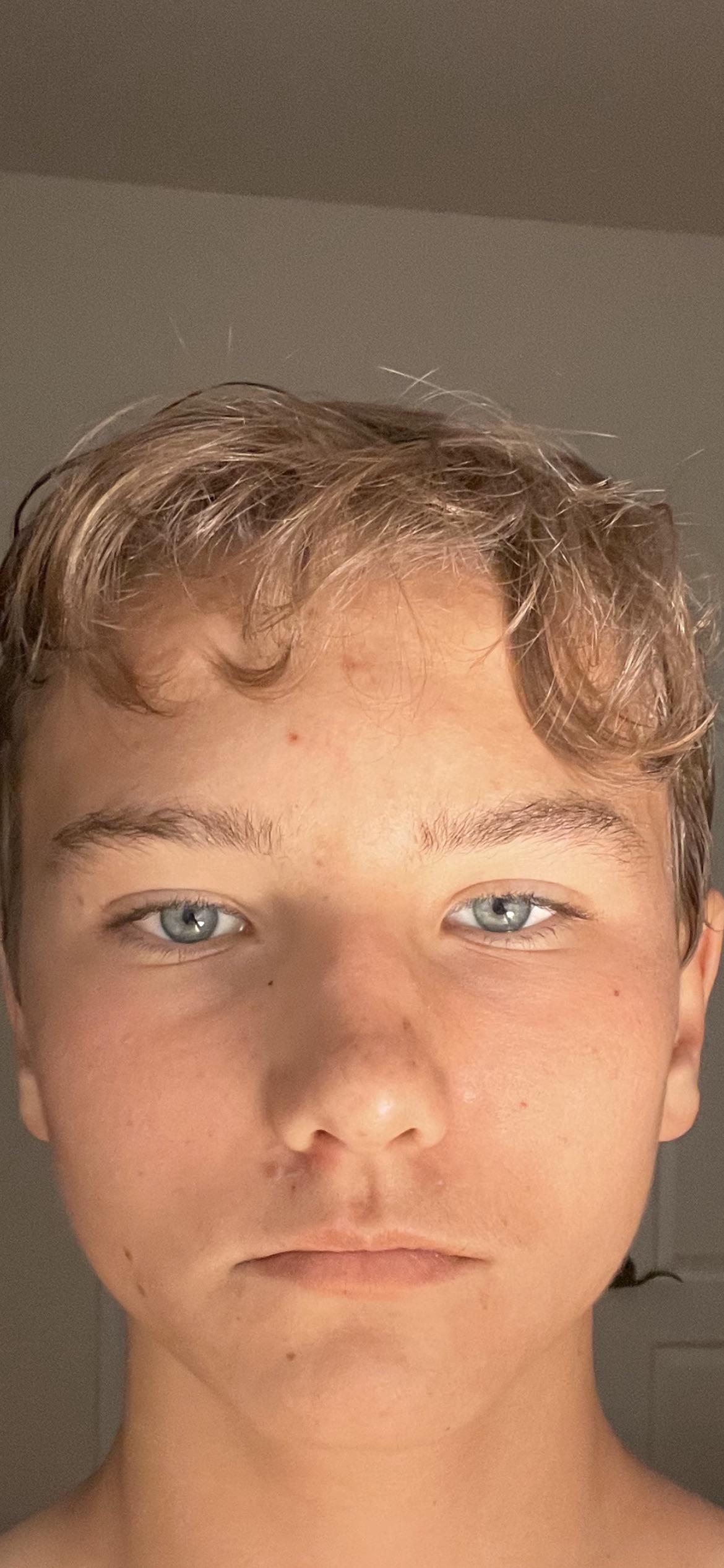 Do I have lazy eye Scrolller
