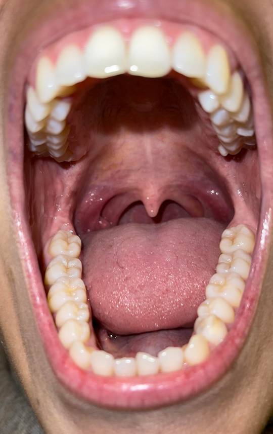 open human mouth