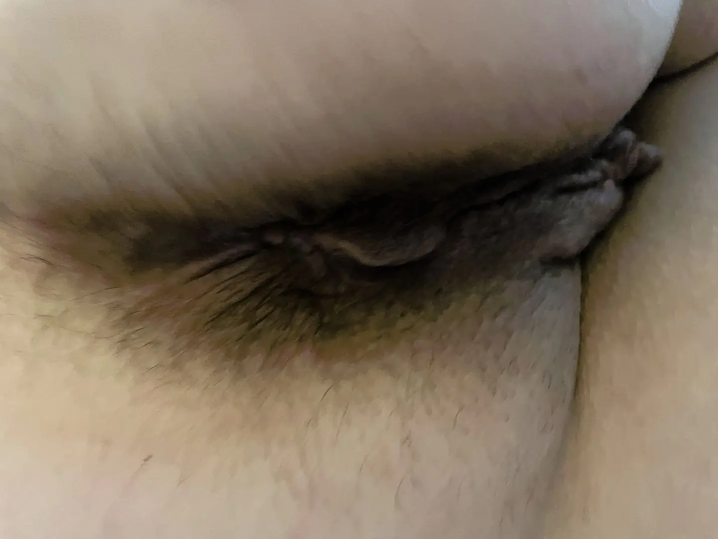 Close-up of a naked person's hairy asshole and pubic area.