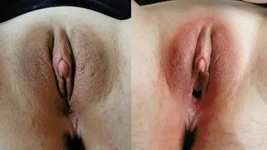Close-up of a woman's puffy pussy and labia showing redness after masturbation.