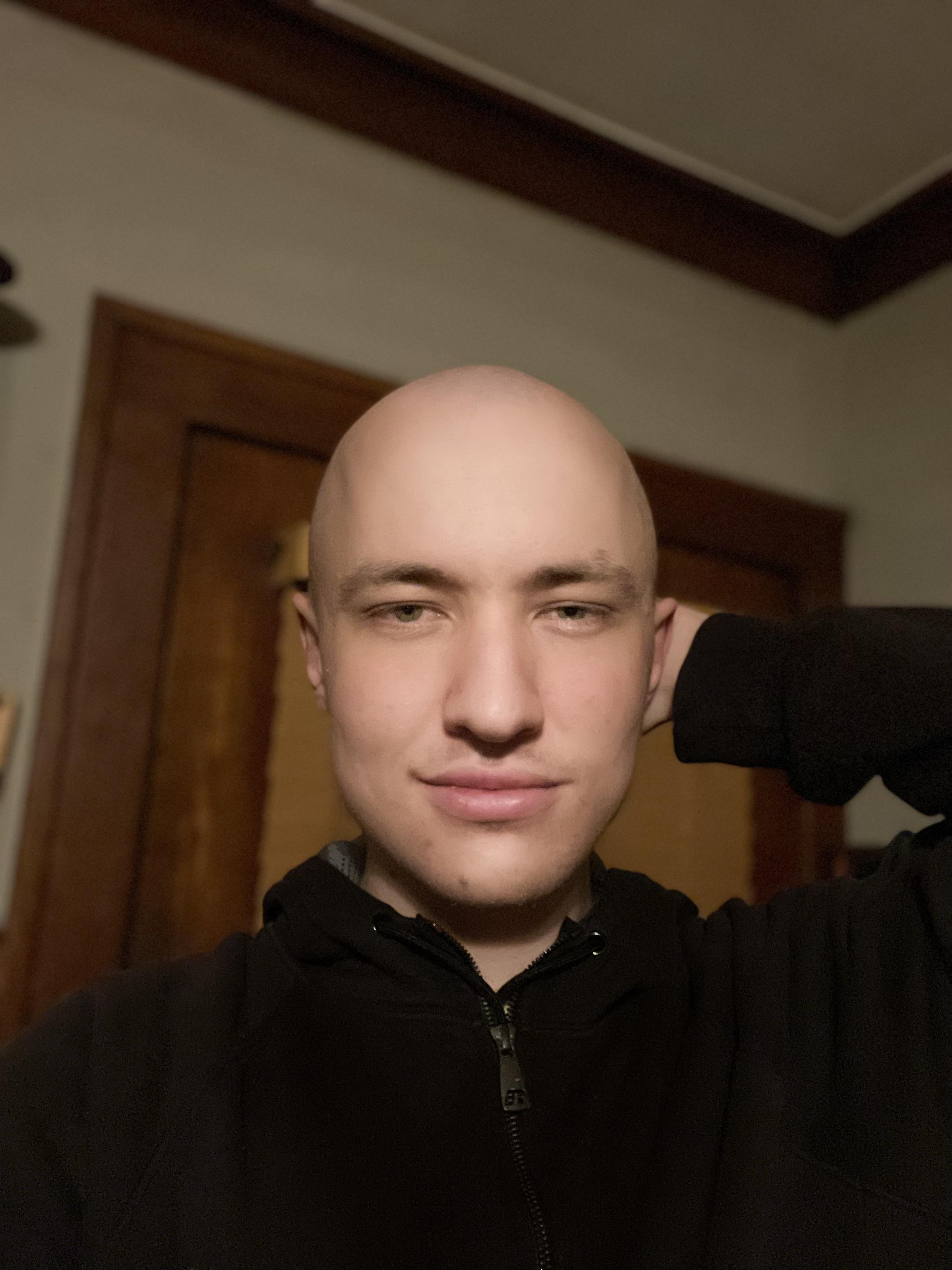 The Bald Life is Feeling Good! | Scrolller