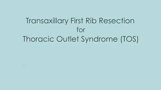 Transaxillary First Rib Resection for Thoracic Outlet Syndrome | Scrolller