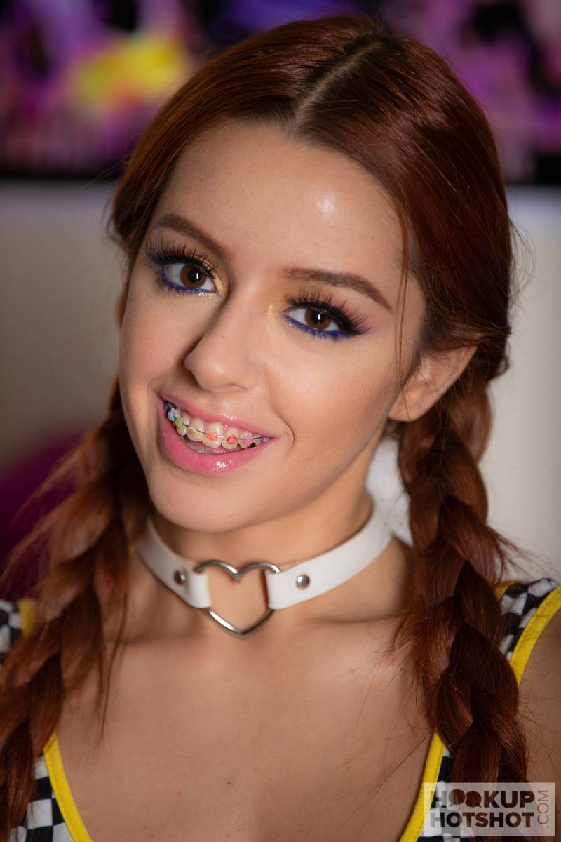 Vanna Bardot closeup of face with Vannas multicolor braces. | Scrolller