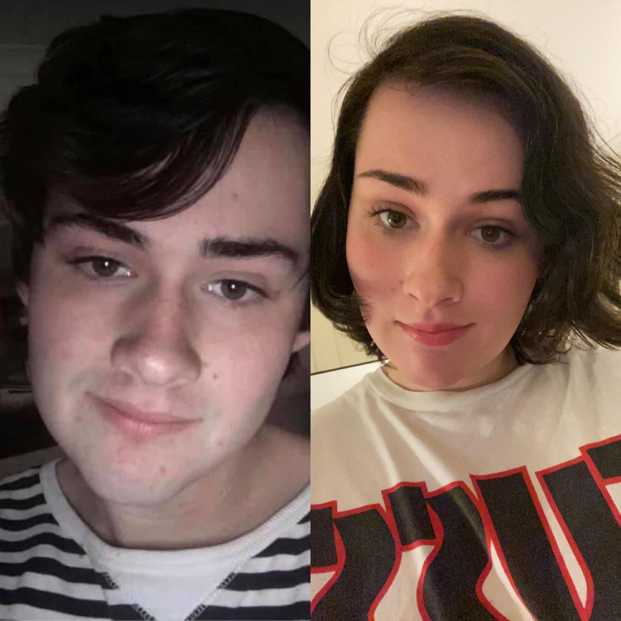 5 Days Hrt Vs 8 Months Hrt Scrolller