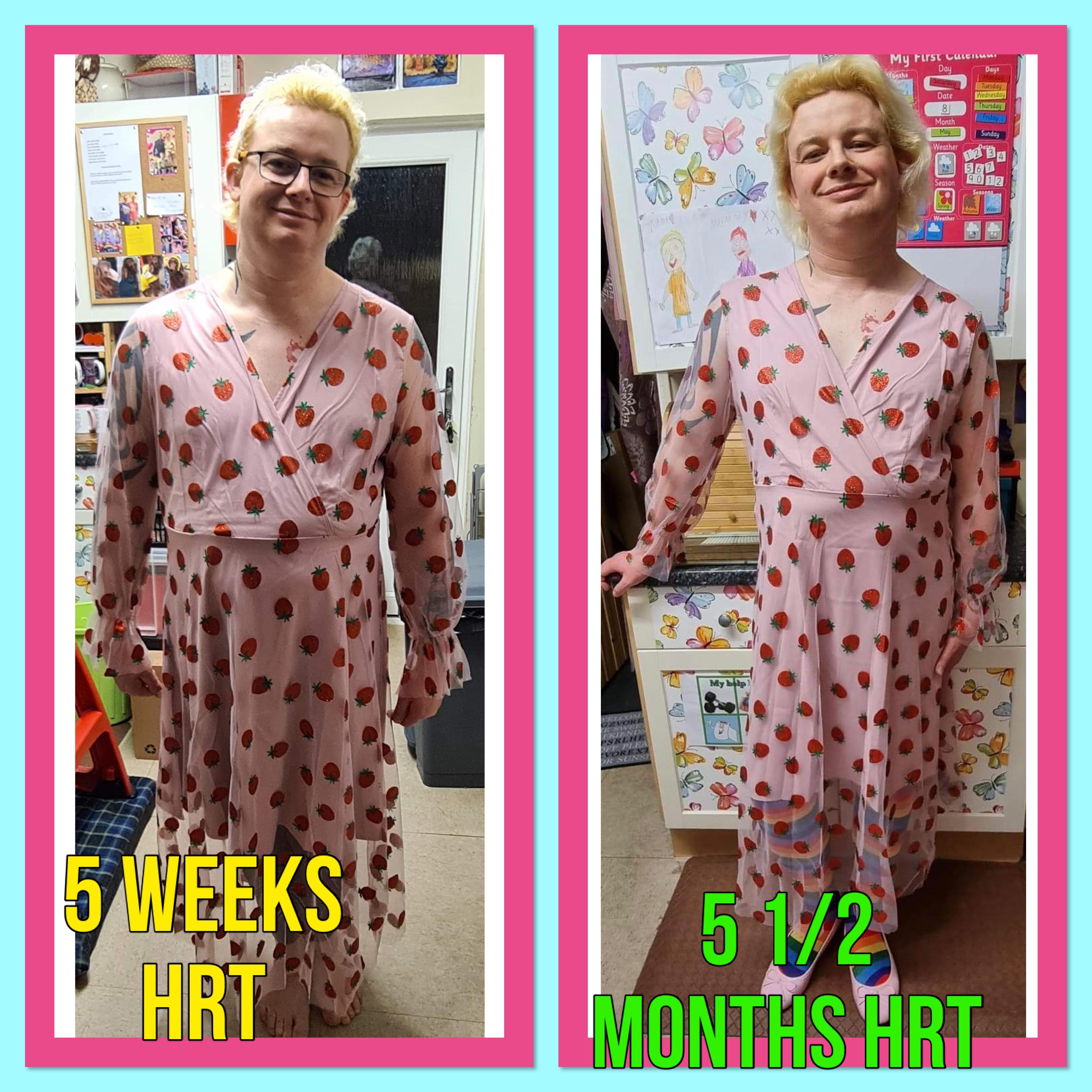 5 Weeks Hrt Vs 5 And A Half Months Hrt Dress Wasnt A Very Good Fit Early On But Seems To Fit 