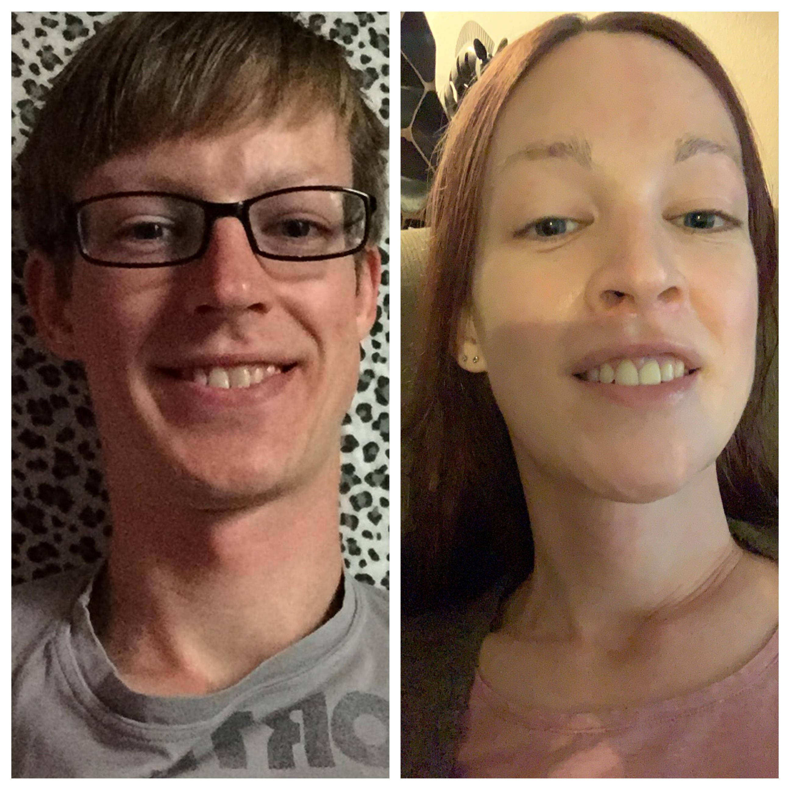 6 years between photos. MTF, 3.5 years HRT, multiple rounds of FFS ...