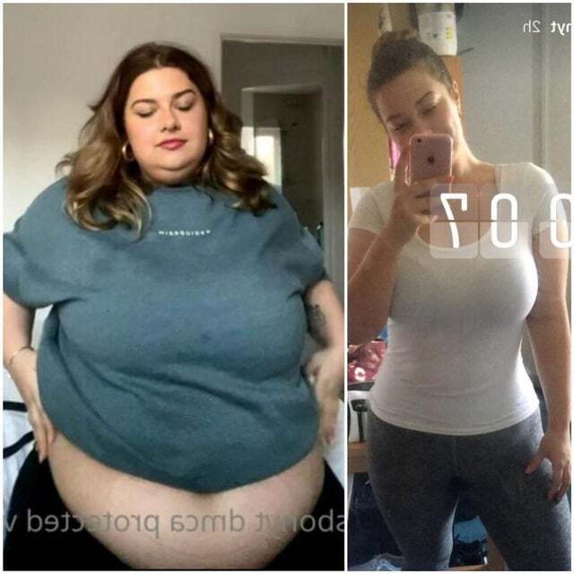 Aliss Bonython's weight gain before and after Scrolller