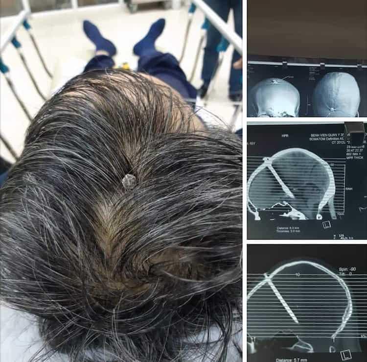 And that’s why you wear a hard hat Scrolller