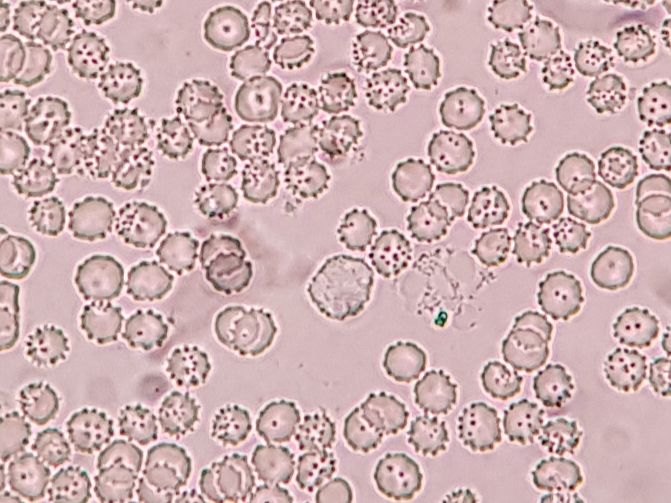 Are these burr cells? And why am I seeing so many? | Scrolller