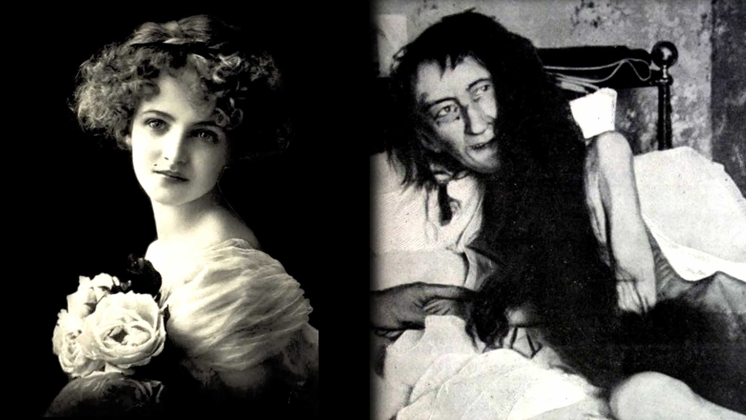 Blanche Monnier before and after being locked in a room for 25 years by