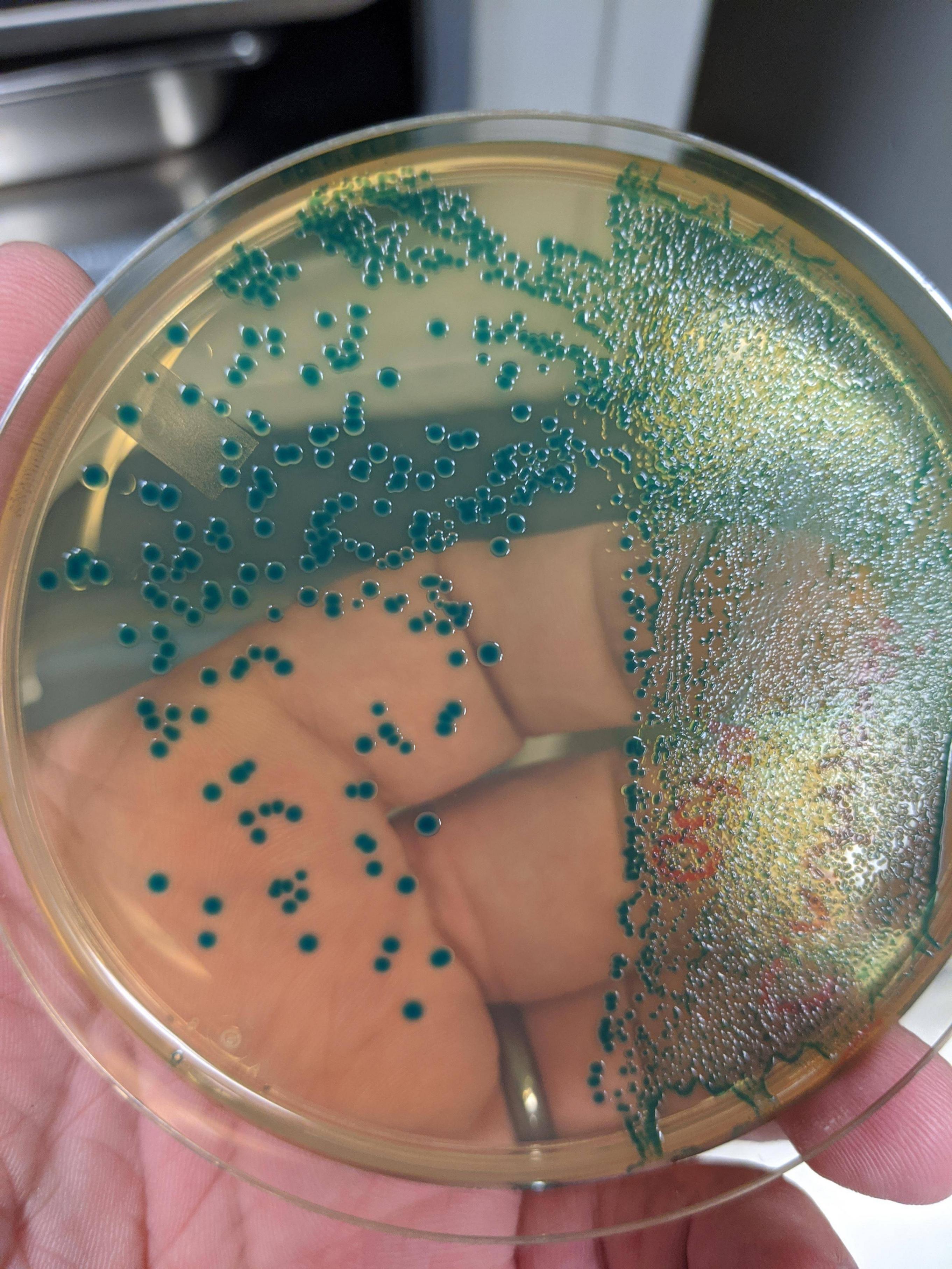 Cronobacter spp. on Cronobacter Chromogenic Isolation Agar | Scrolller