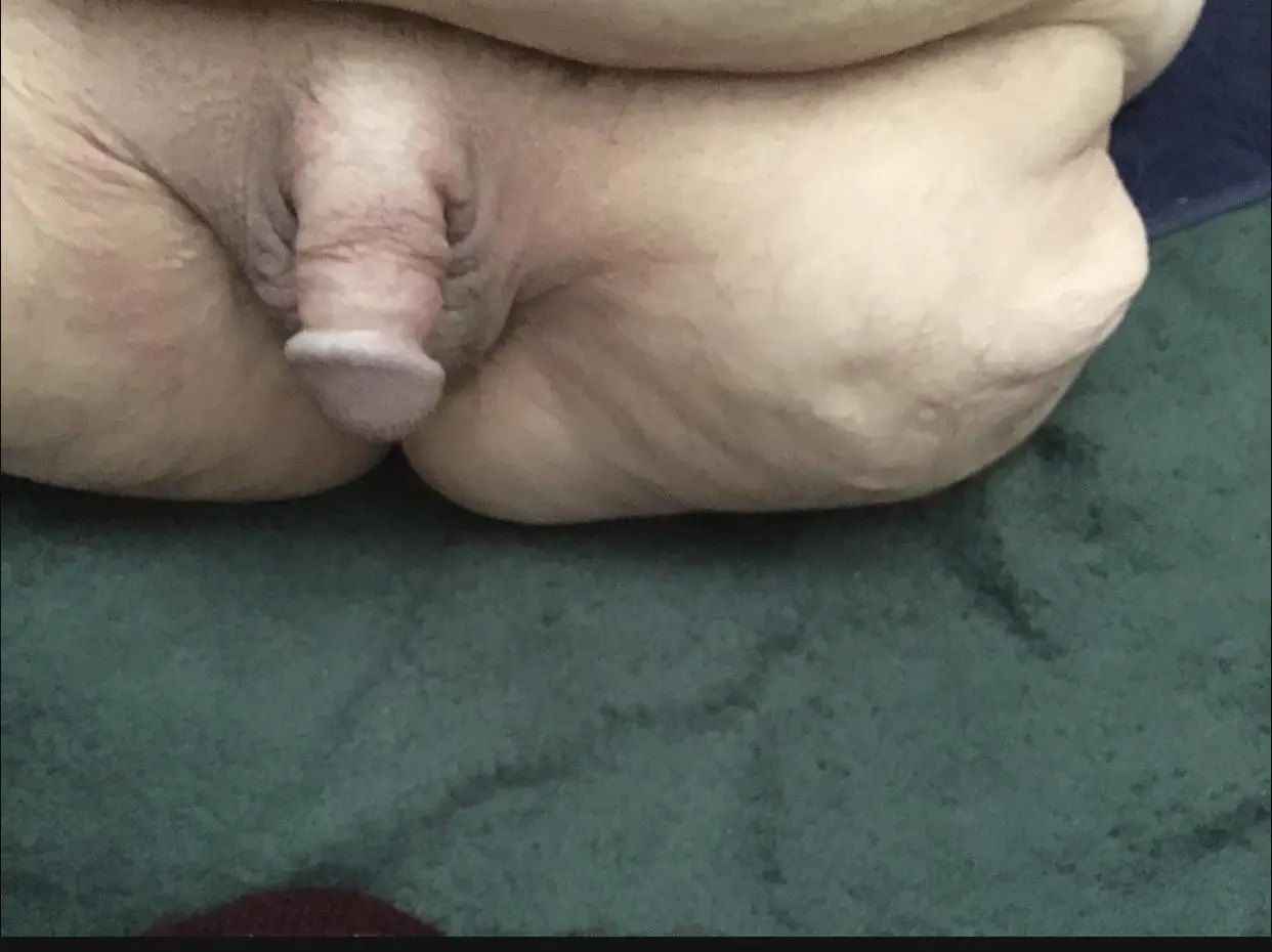 Dual leg amputee who started an onlyfans. Full stump &amp; penis videos &amp; pics. See link in comments.