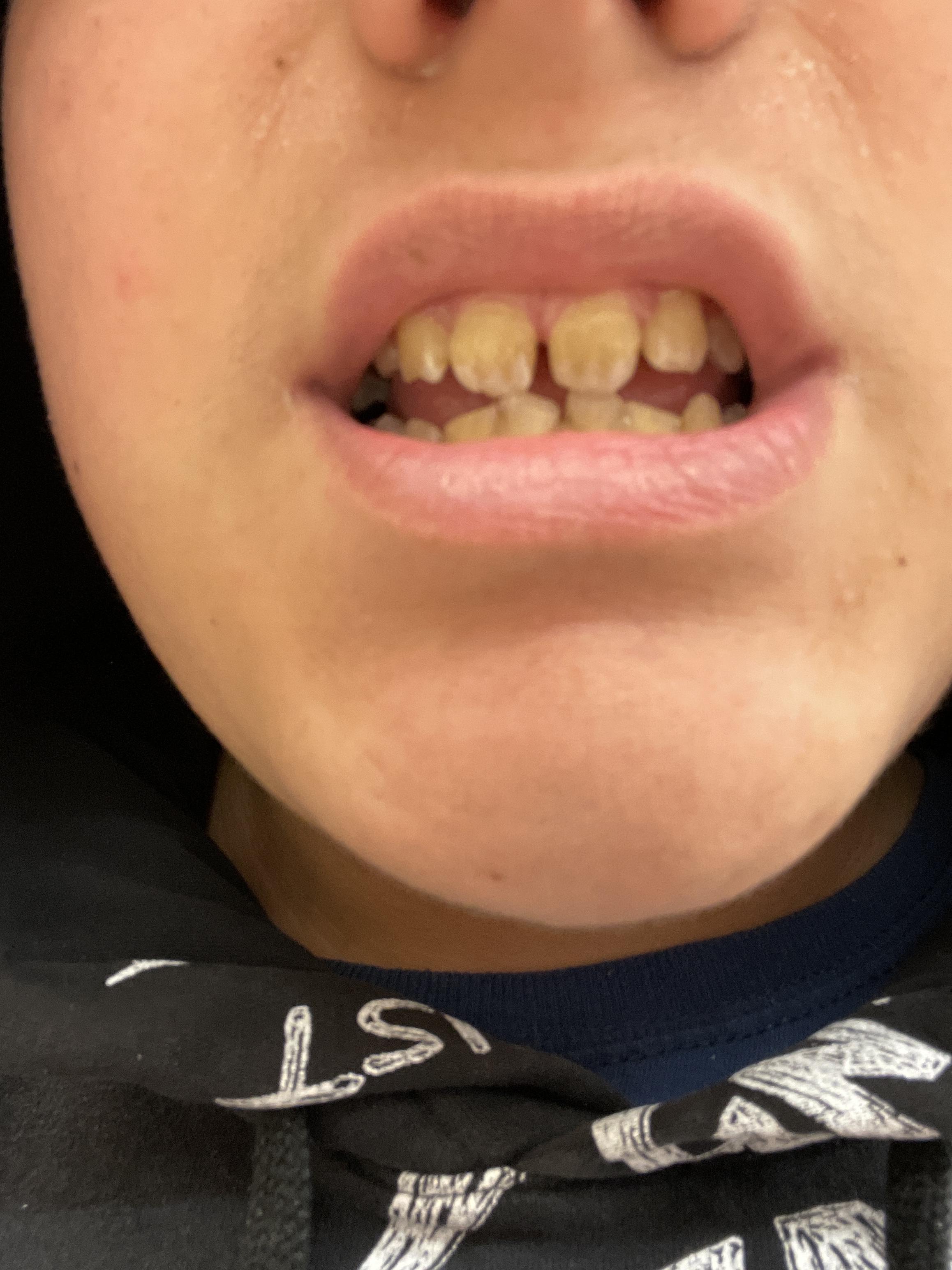 to brush my teeth this morning FML Scrolller